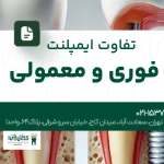 تفاوت ایمپلنت فوری و معمولی