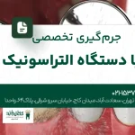 جرمگیری تخصصی با دستگاه التراسونیک