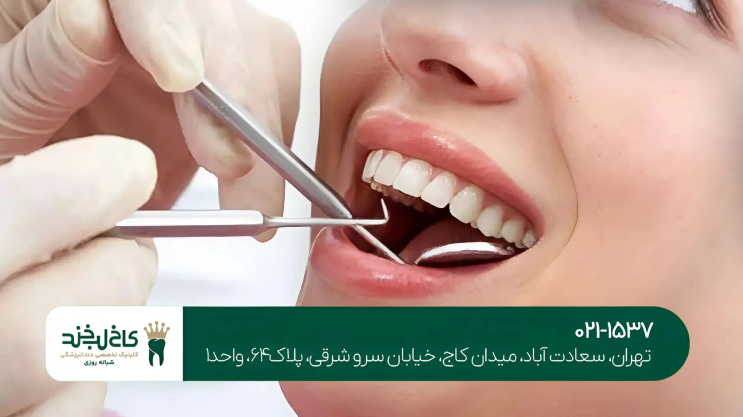 ایمپلنت دیجیتال با دستگاه سهبعدی