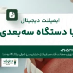 ایمپلنت دیجیتال با دستگاه سهبعدی