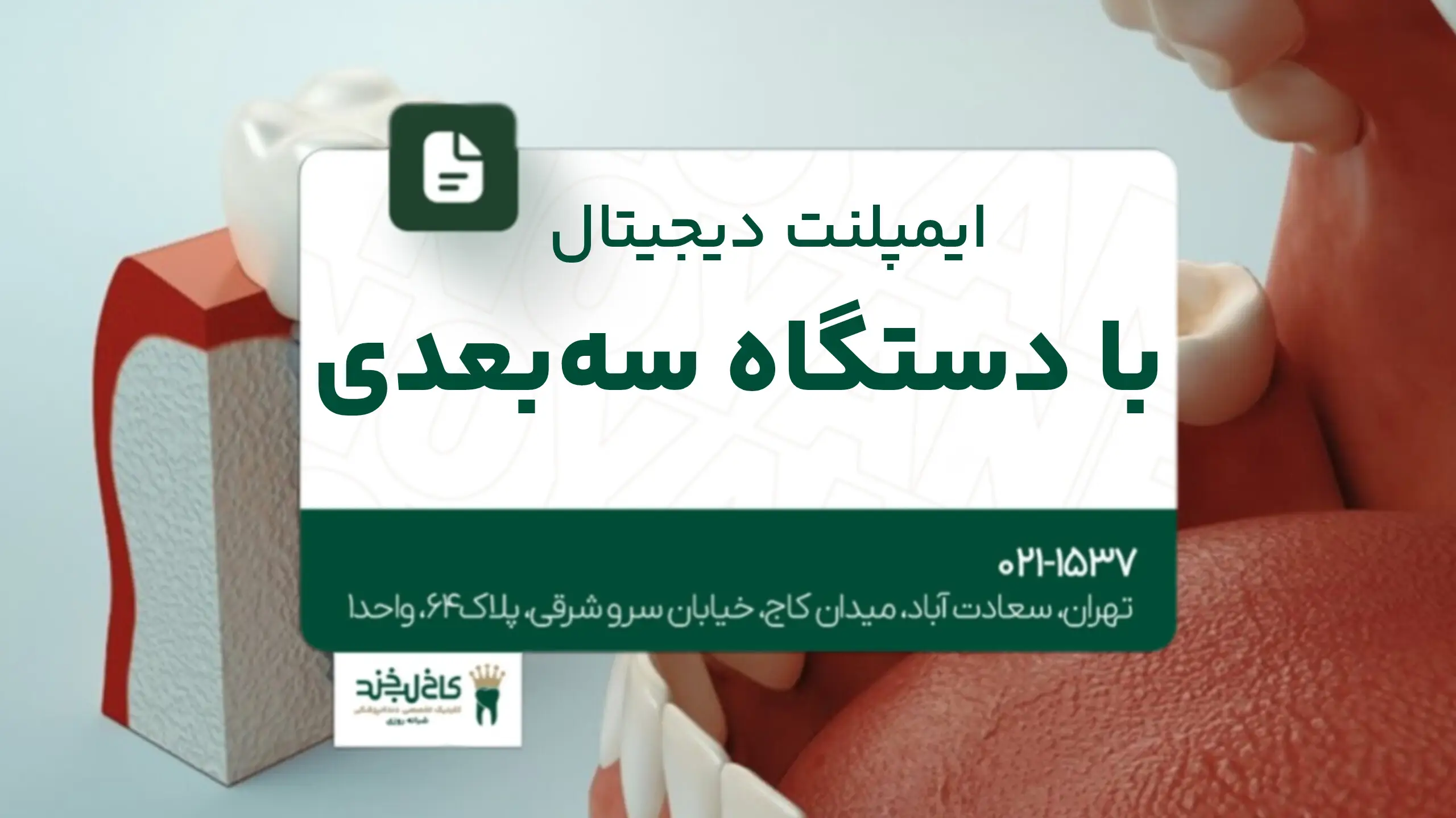 ایمپلنت دیجیتال با دستگاه سهبعدی
