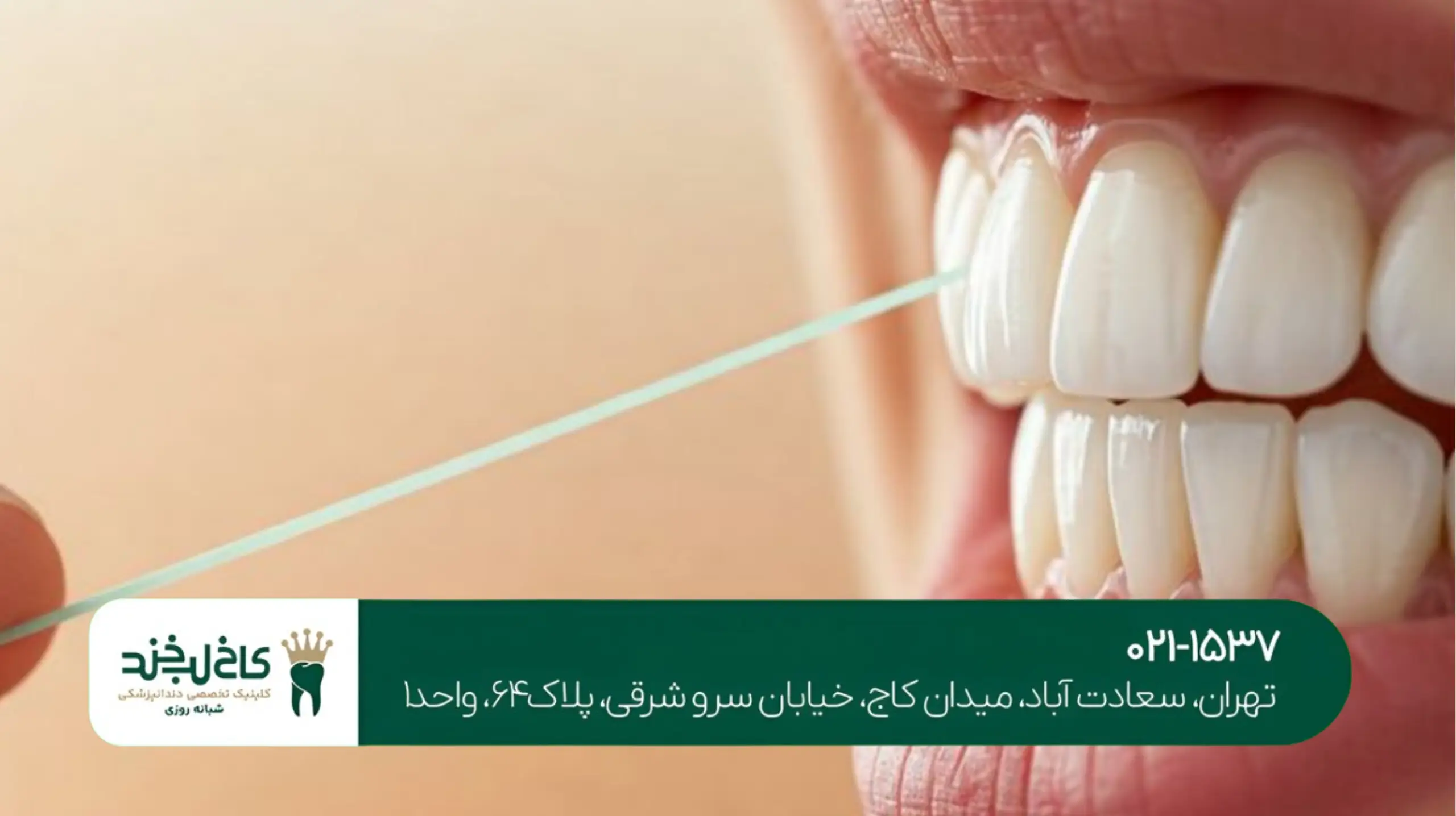 درمان لثه تحلیل رفته در کلینیک تخصصی