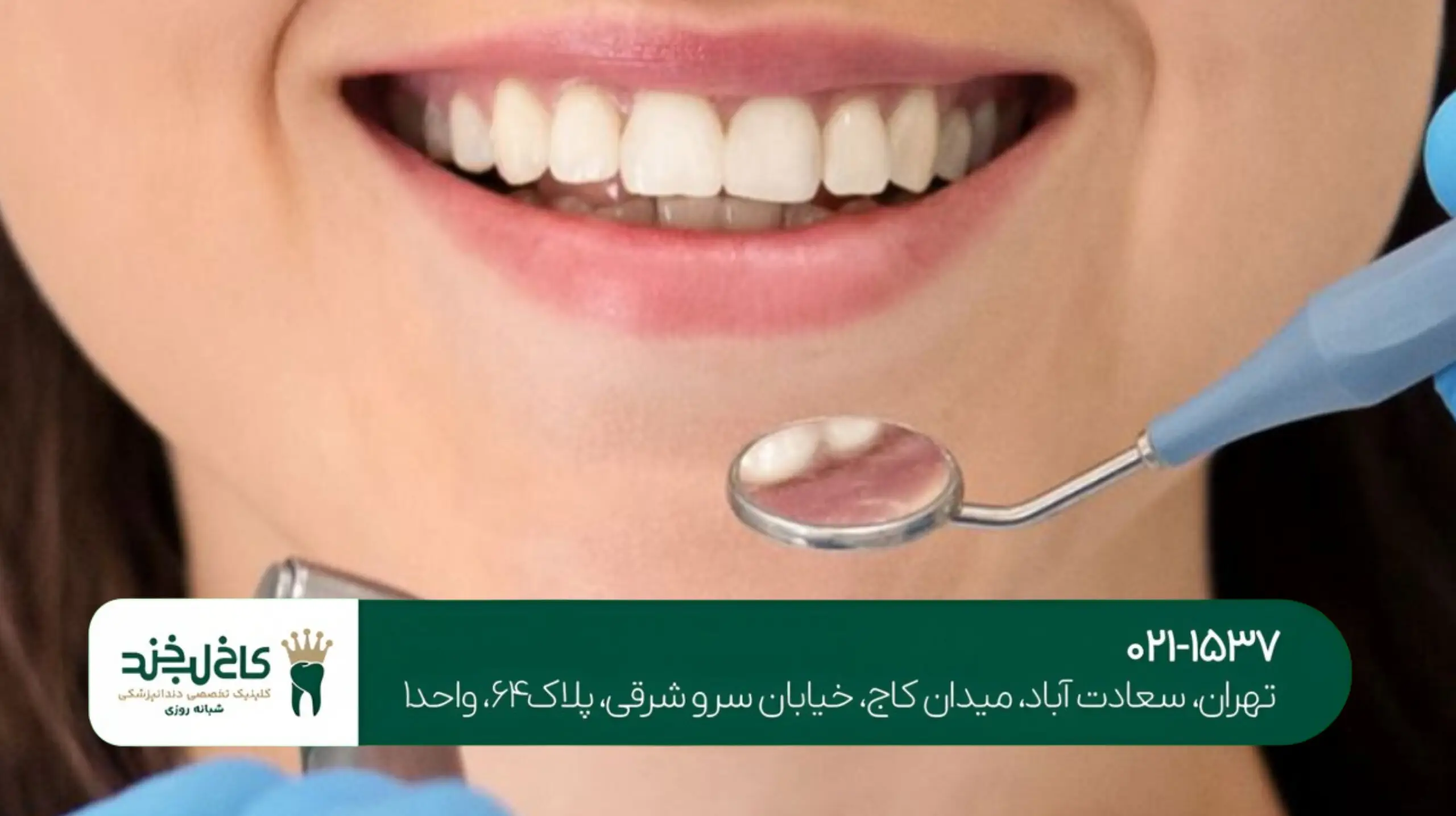 درمان لثه تحلیل رفته در کلینیک تخصصی