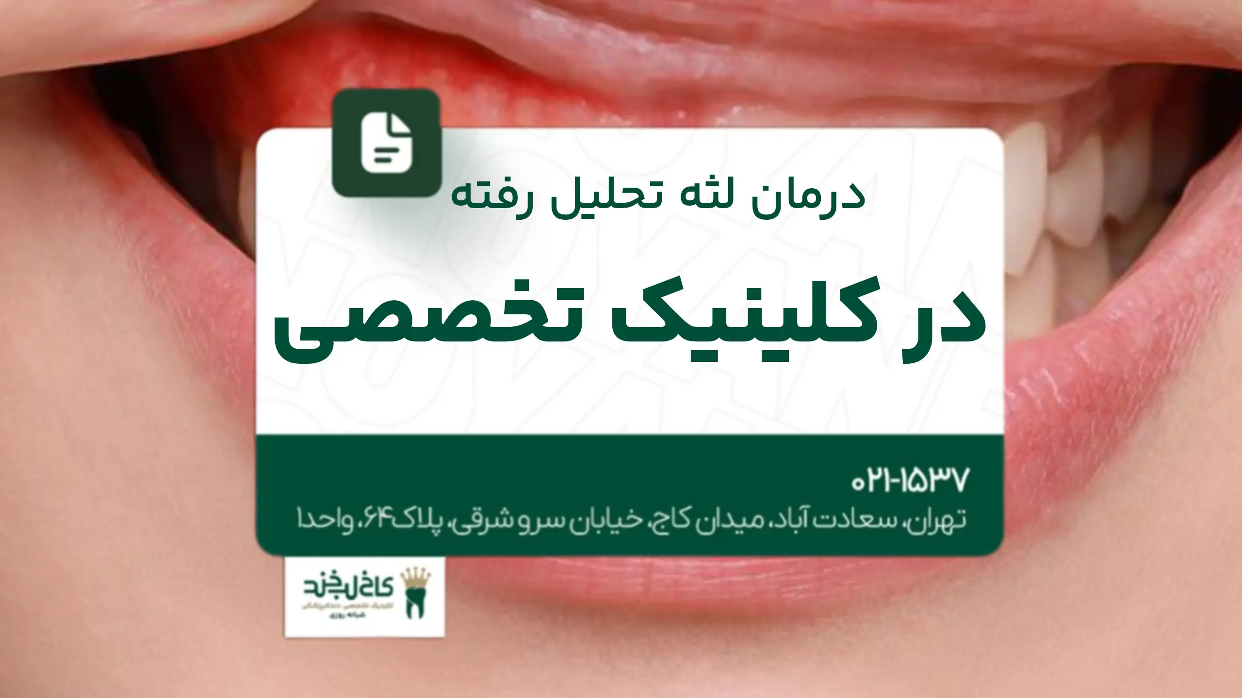 درمان لثه تحلیل رفته در کلینیک تخصصی