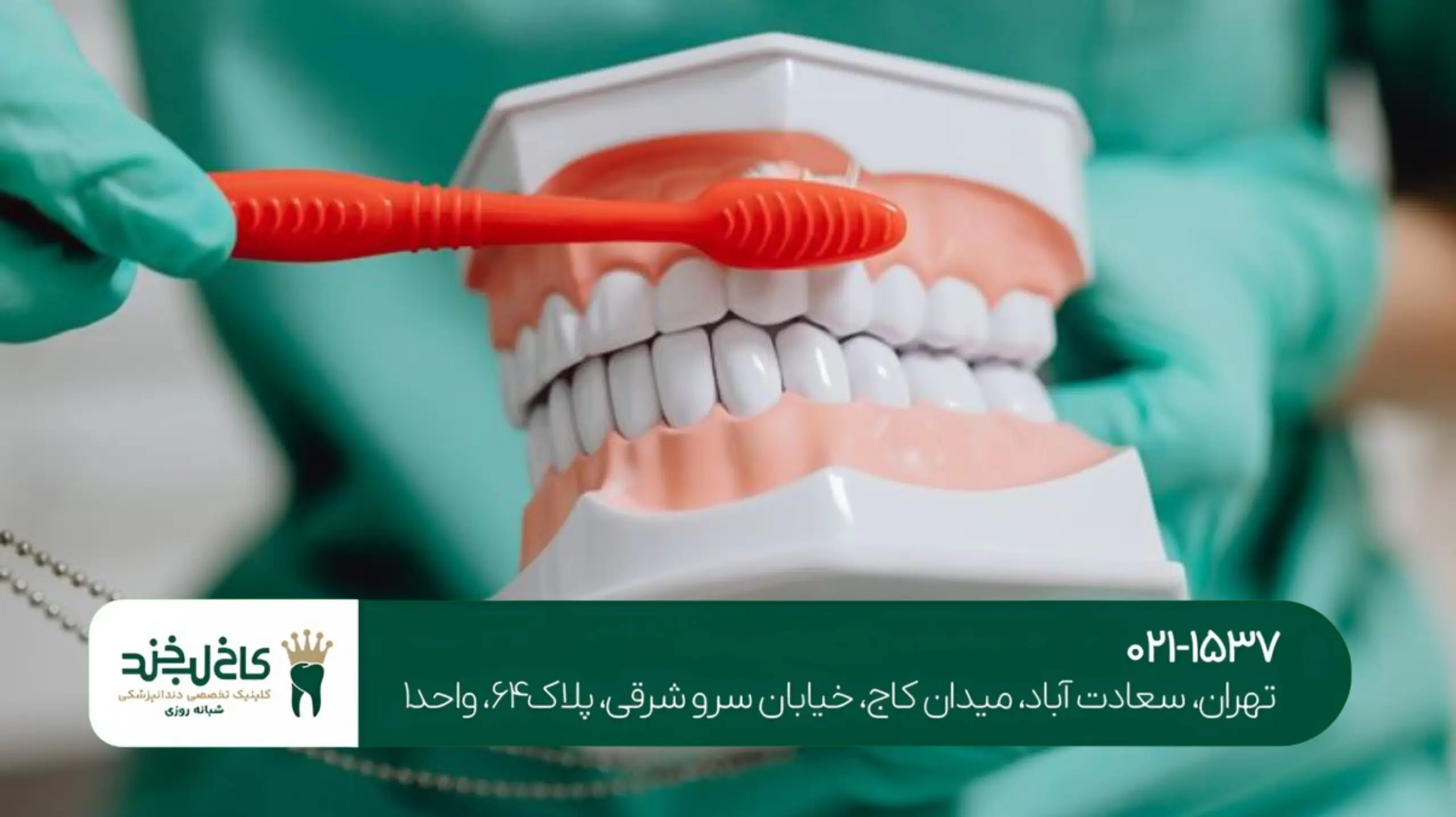 هزینه اصلاح طرح لبخند در تهران