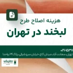 هزینه اصلاح طرح لبخند در تهران