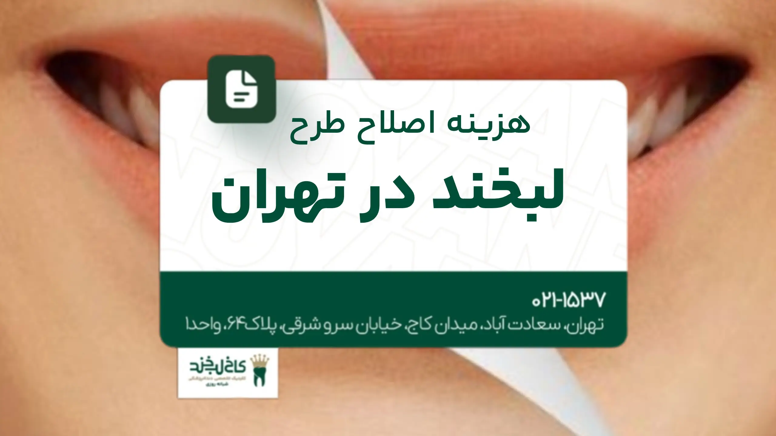 هزینه اصلاح طرح لبخند در تهران