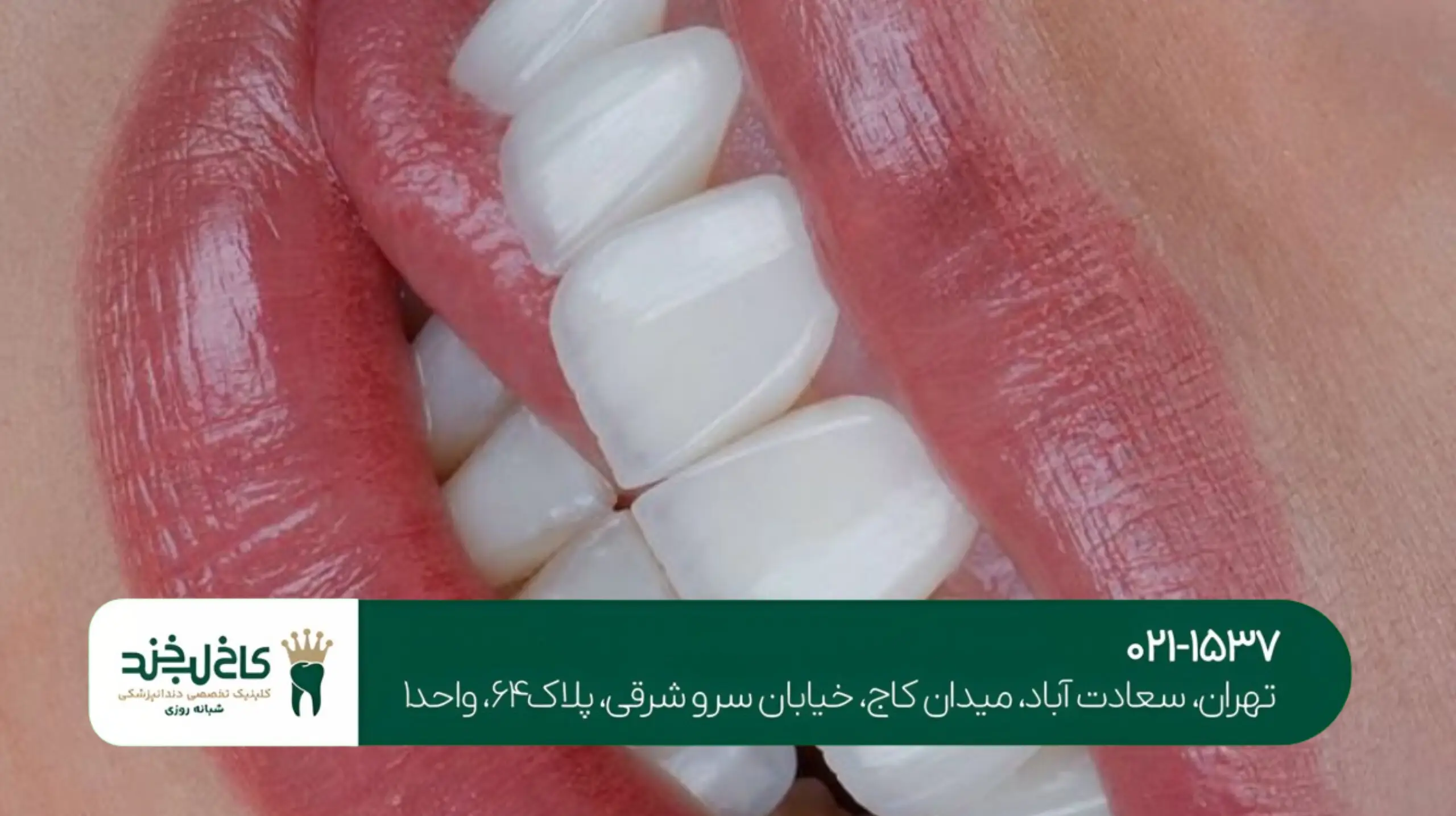 دندانپزشکی زیبایی تخصصی خانمها