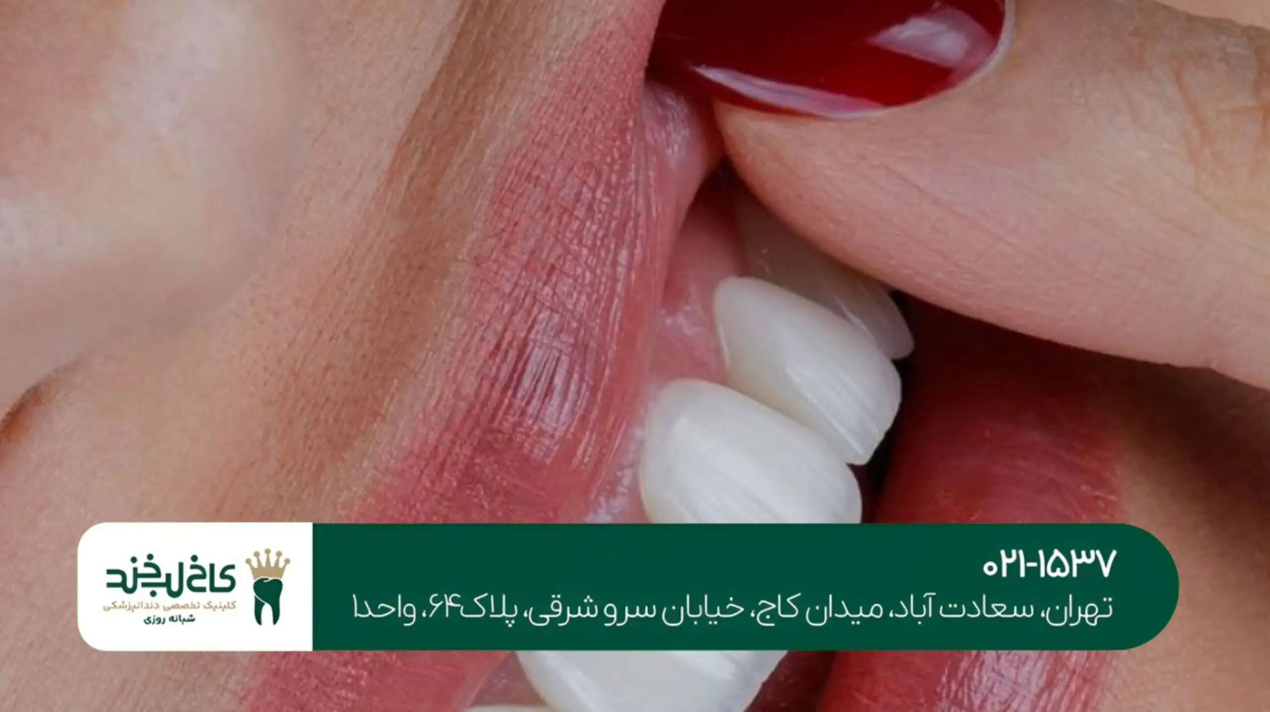 دندانپزشکی زیبایی تخصصی خانمها