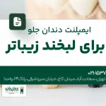 ایمپلنت دندان جلو برای لبخند زیباتر