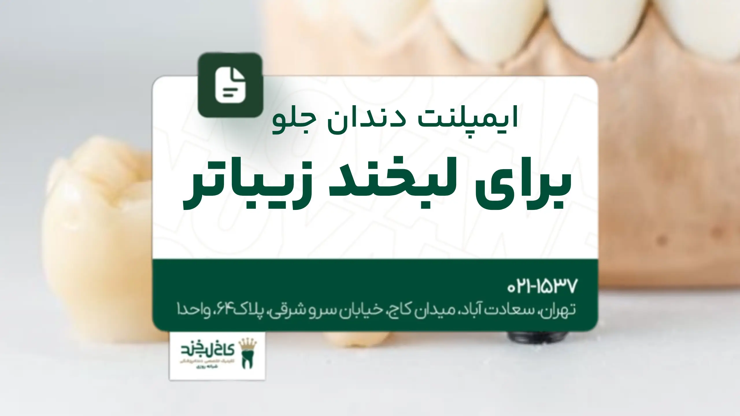 ایمپلنت دندان جلو برای لبخند زیباتر