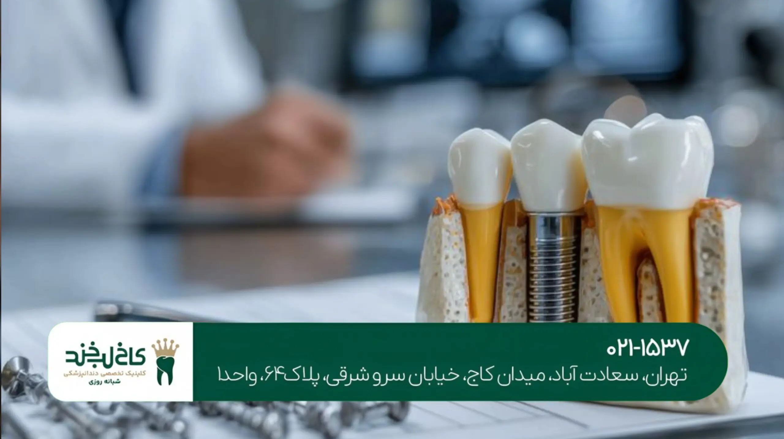 چه کسانی نمیتوانند ایمپلنت انجام دهند؟