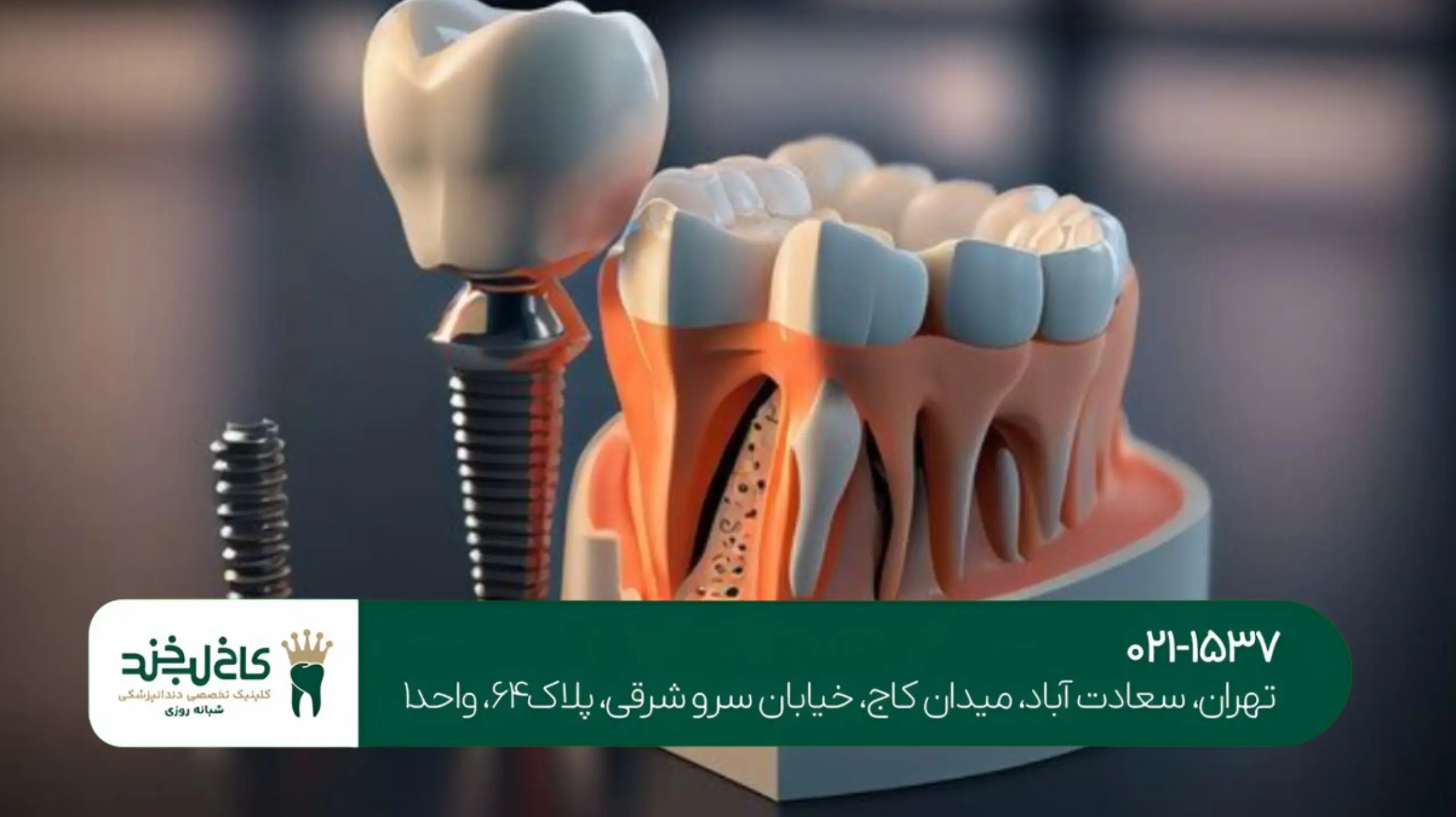 چه کسانی نمیتوانند ایمپلنت انجام دهند؟