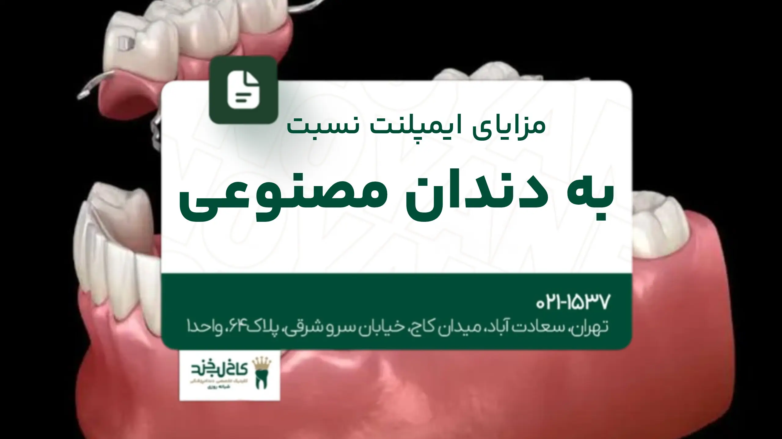 مزایای ایمپلنت نسبت به دندان مصنوعی