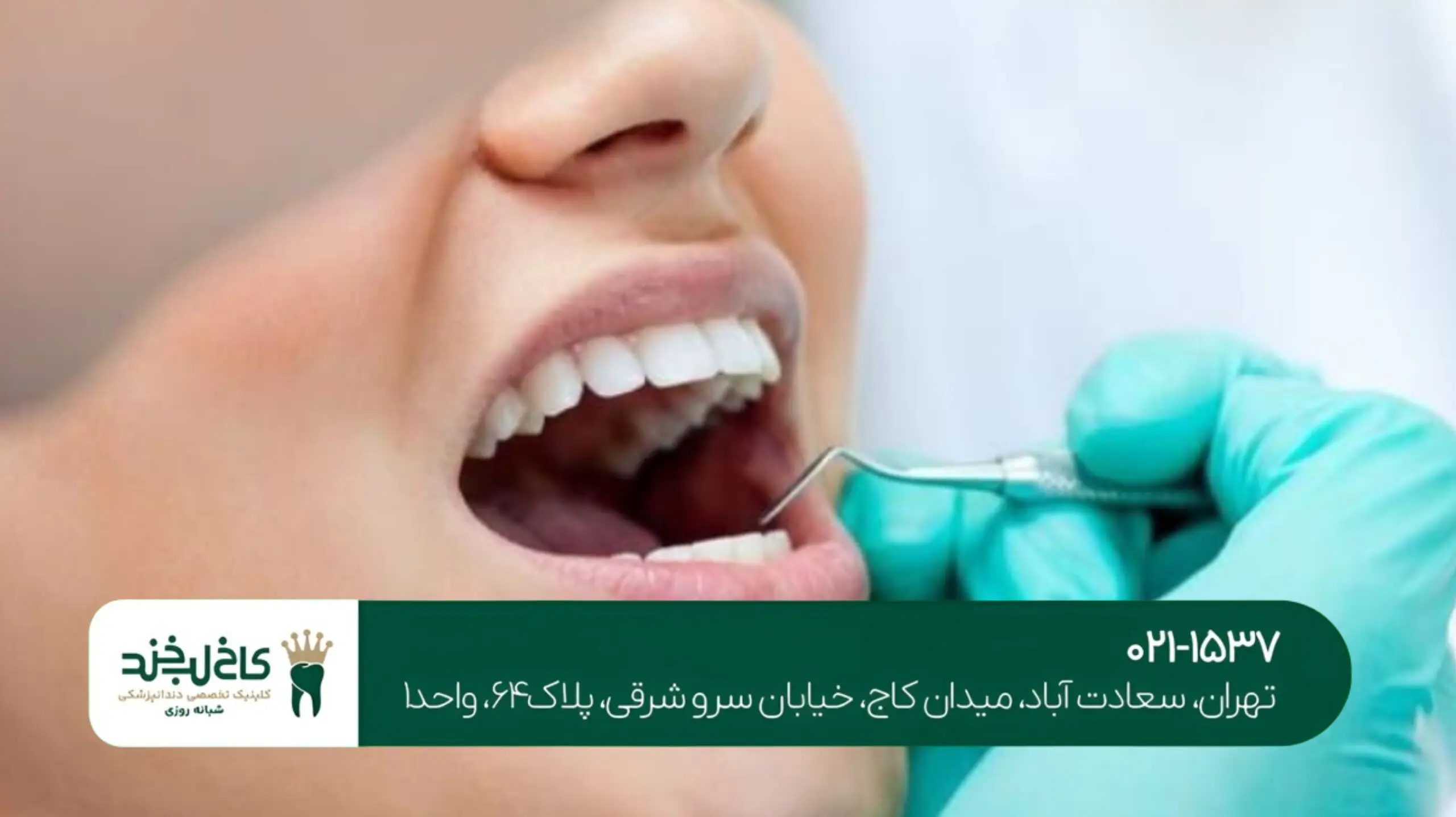 مزایای ایمپلنت نسبت به دندان مصنوعی