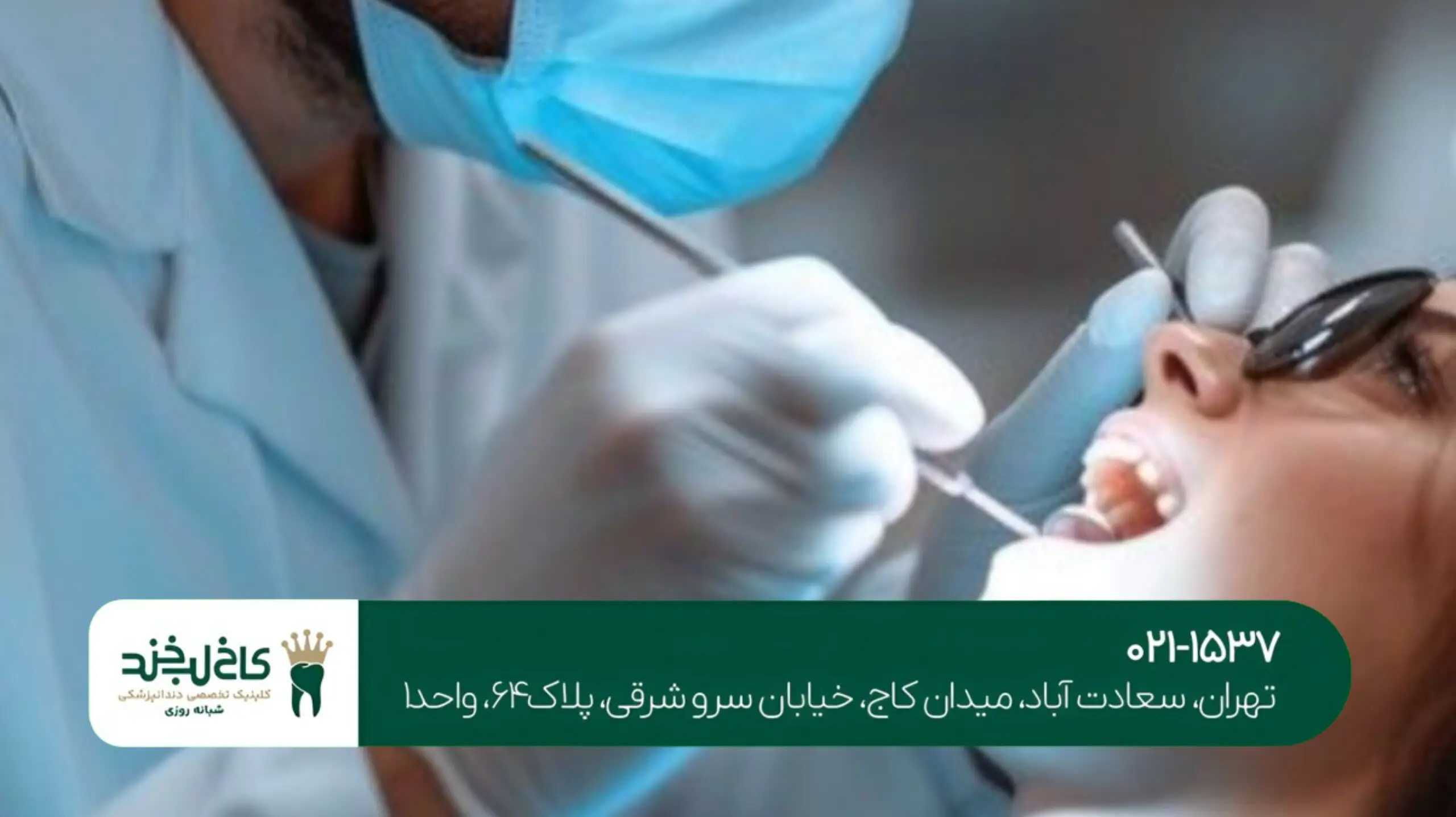 ایمپلنت دندان جلو برای لبخند زیباتر