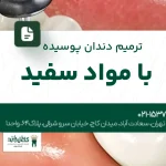 ترمیم دندان پوسیده با مواد سفید