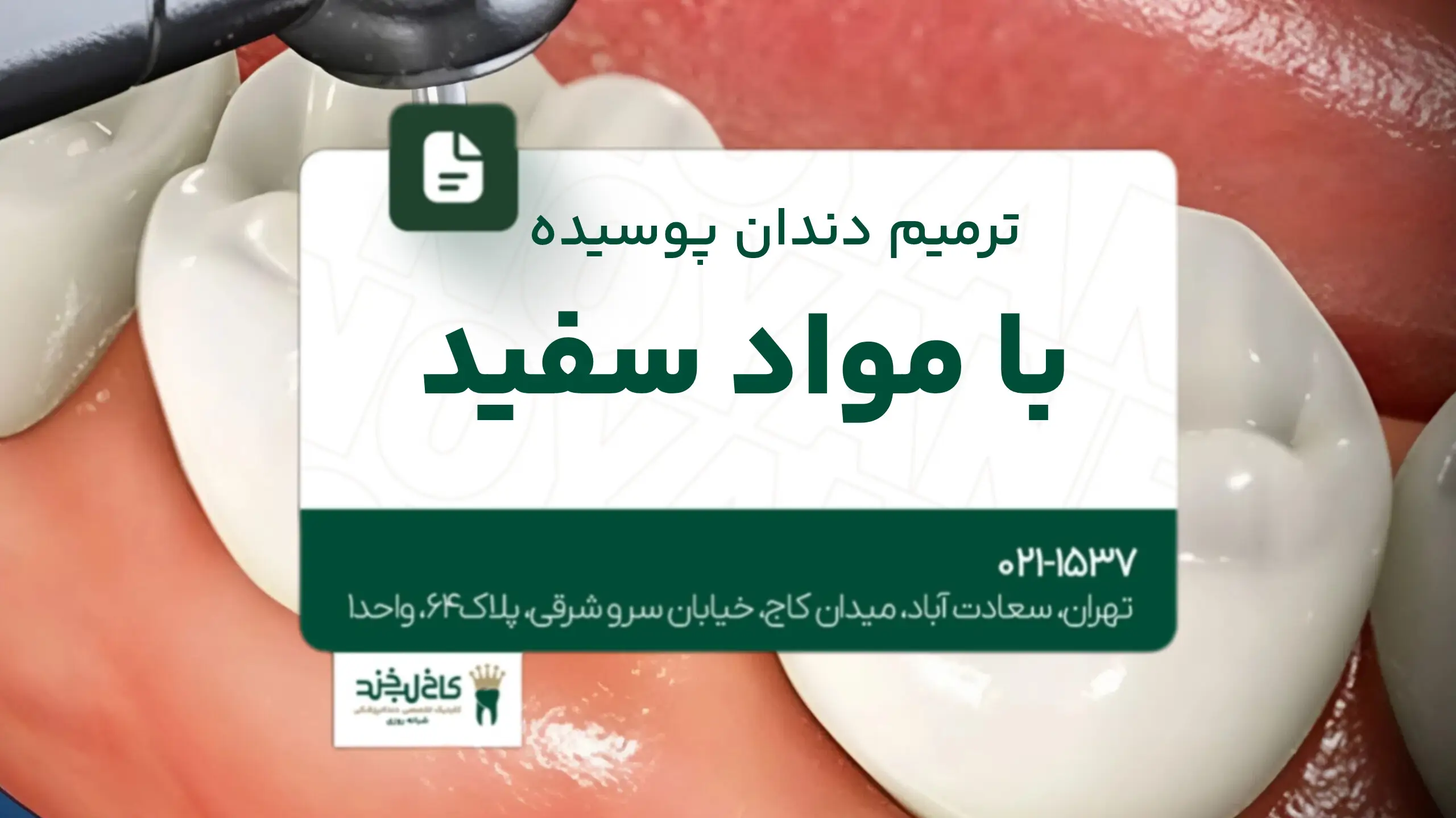 ترمیم دندان پوسیده با مواد سفید