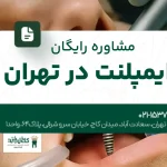 مشاوره رایگان ایمپلنت در تهران