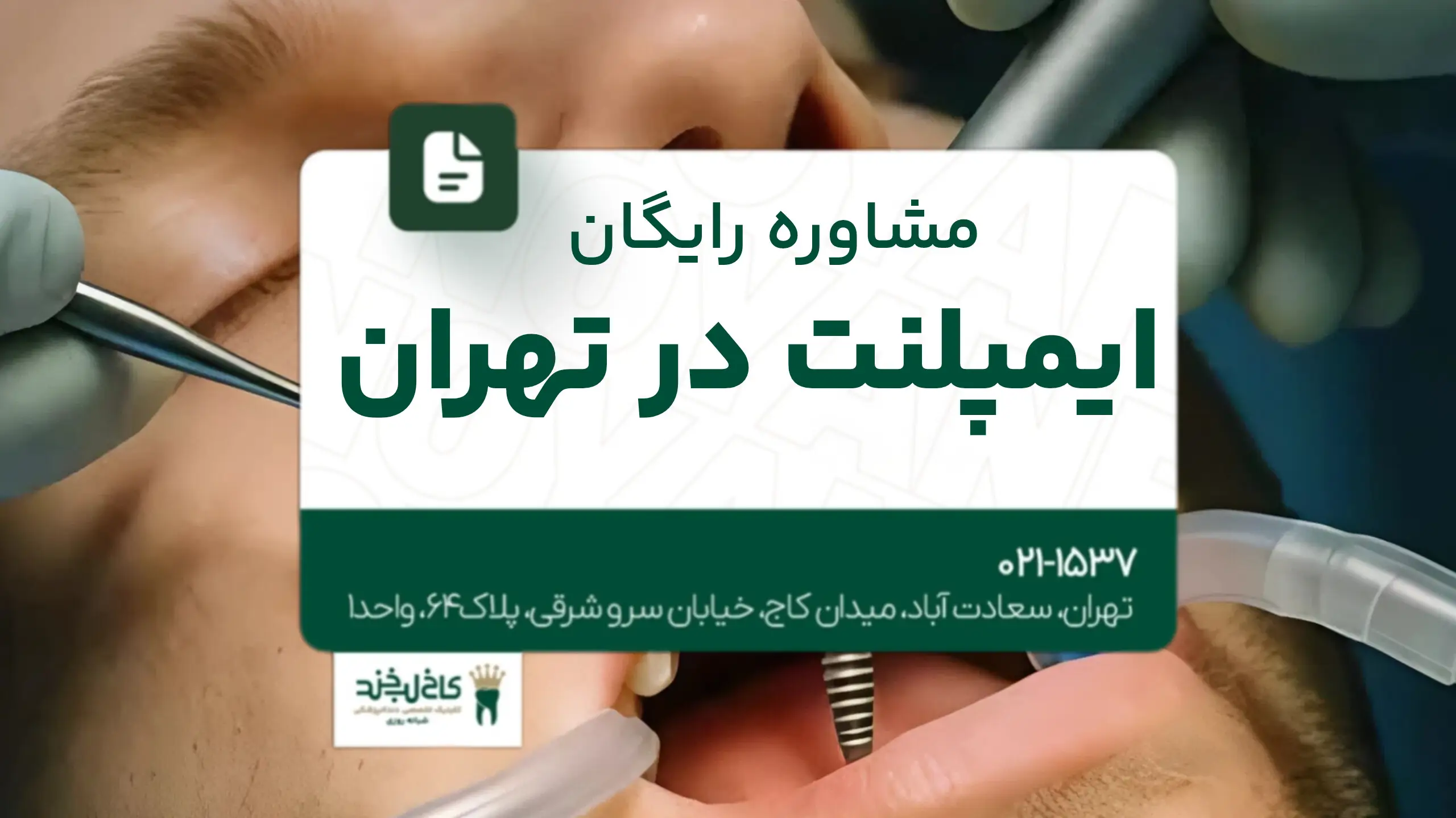 مشاوره رایگان ایمپلنت در تهران