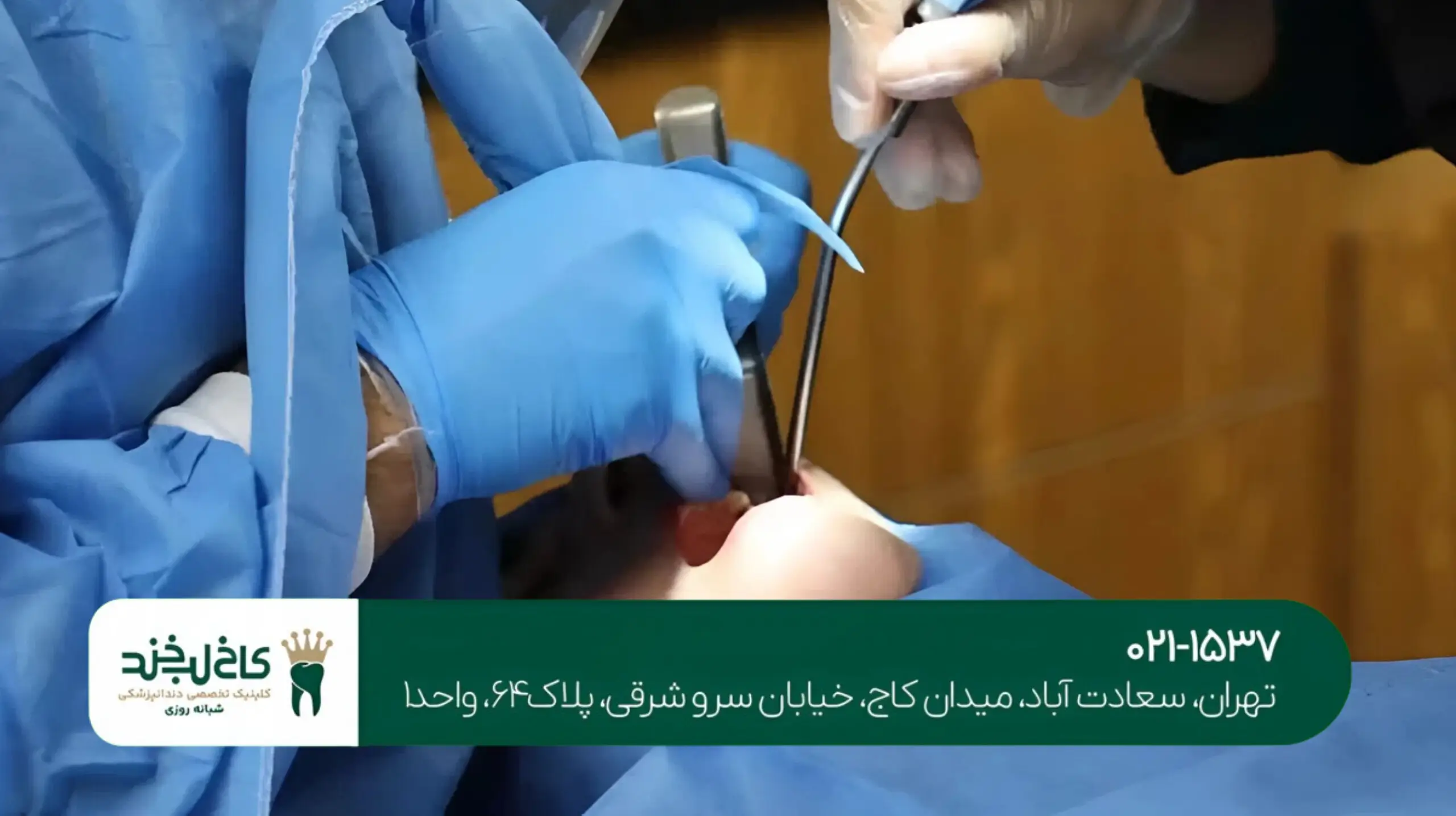 مشاوره رایگان ایمپلنت در تهران