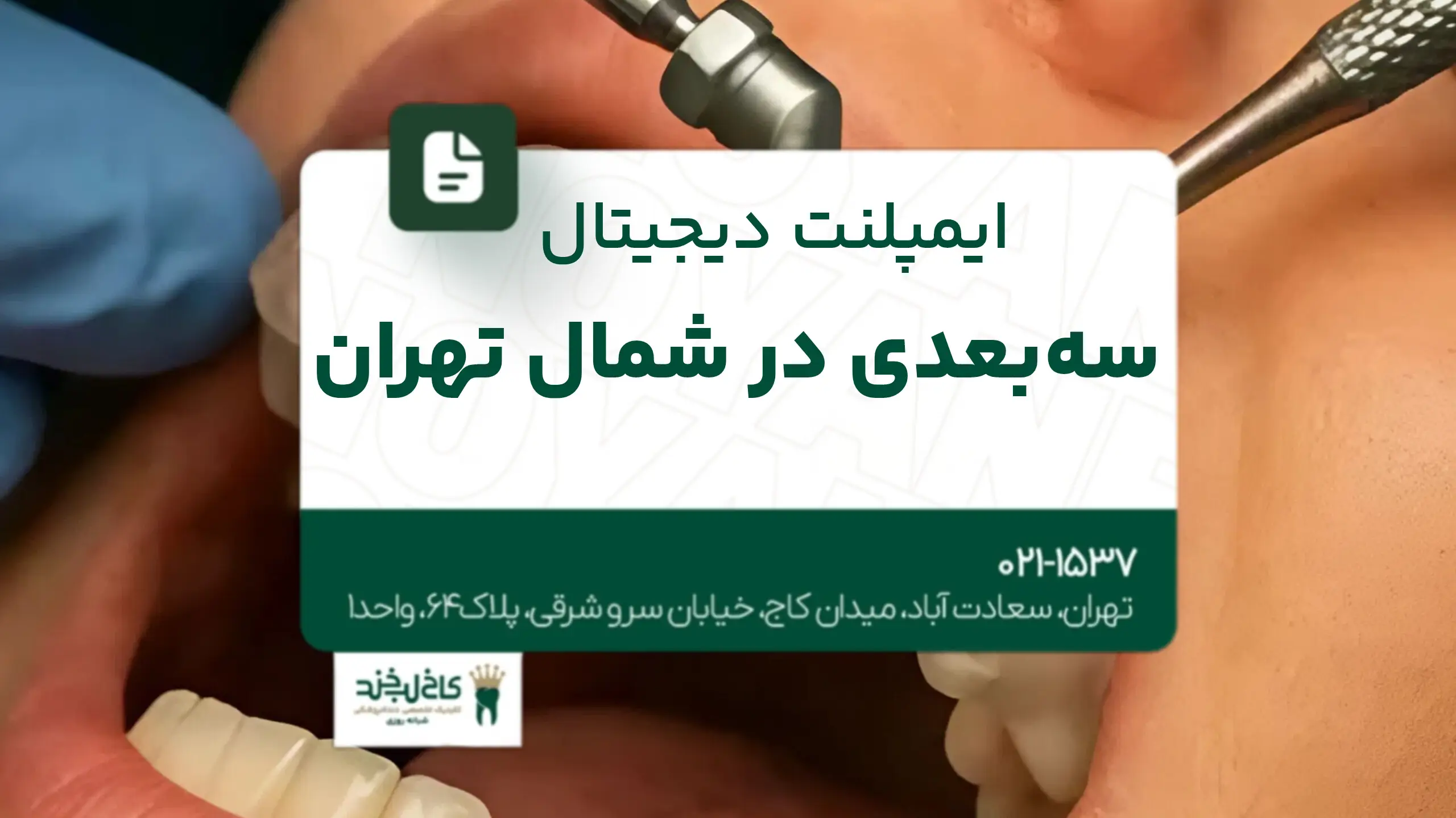 ایمپلنت دیجیتال سه‌بعدی در شمال تهران