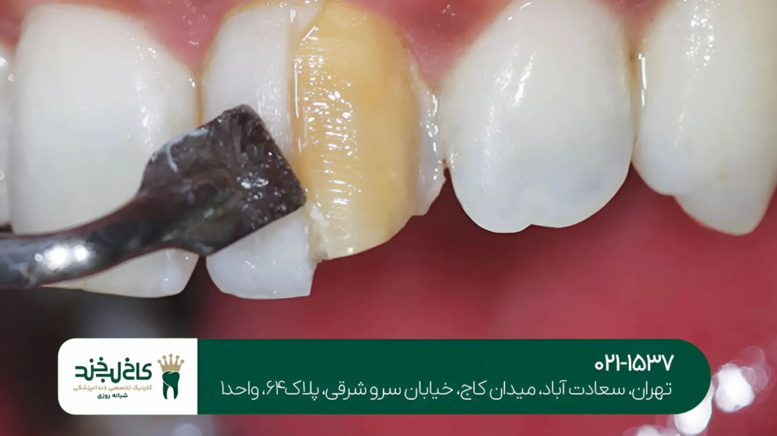 دندانپزشکی در سعادت آباد