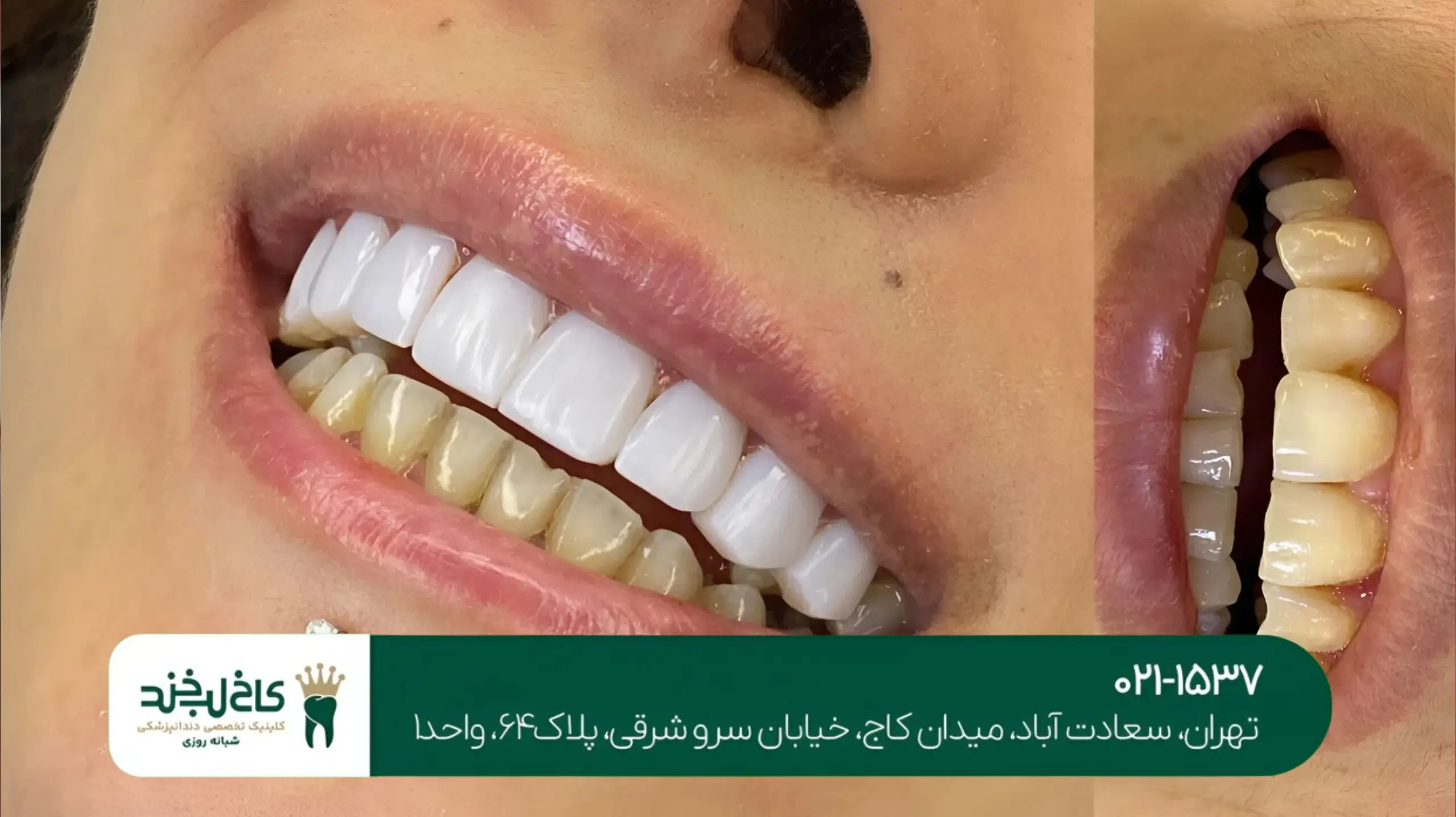 دندانپزشکی در سعادت آباد