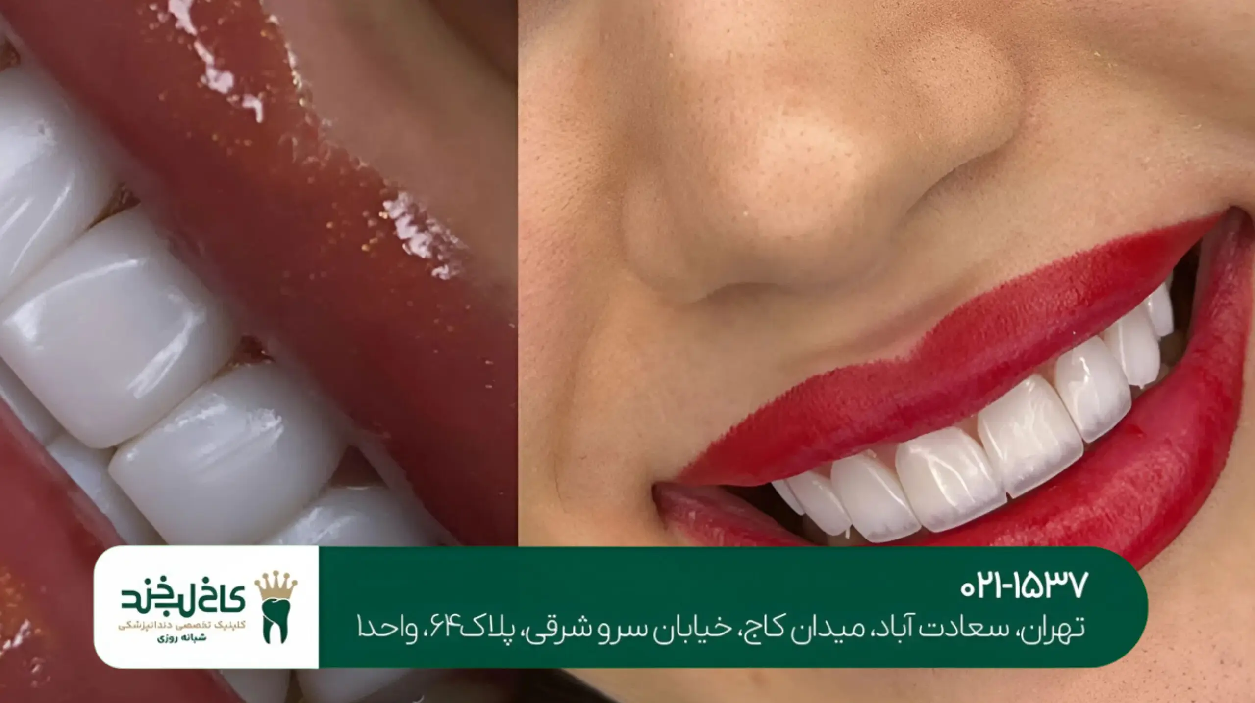 دندانپزشکی در سعادت آباد