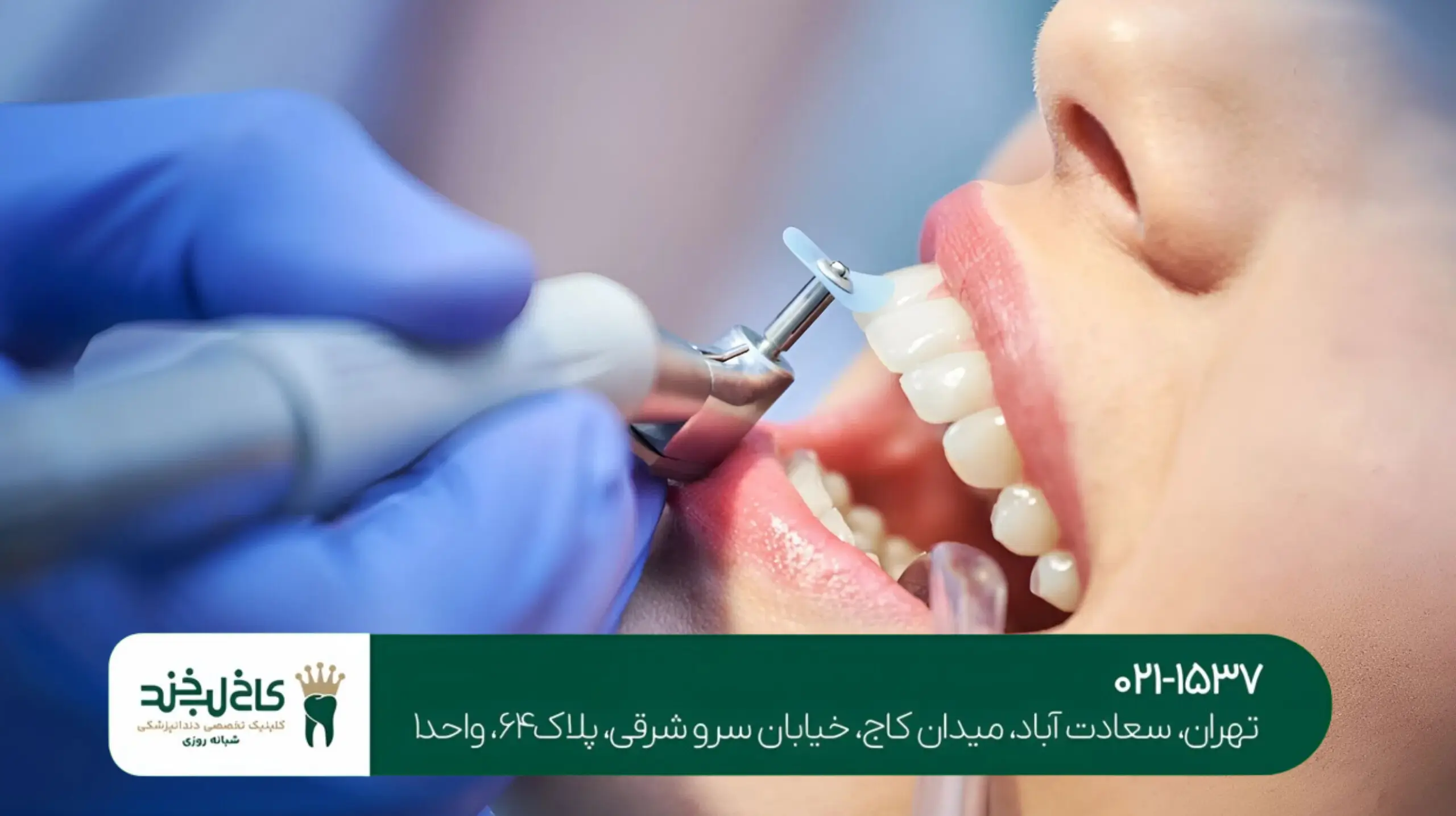 انتخاب بهترین دندانپزشک