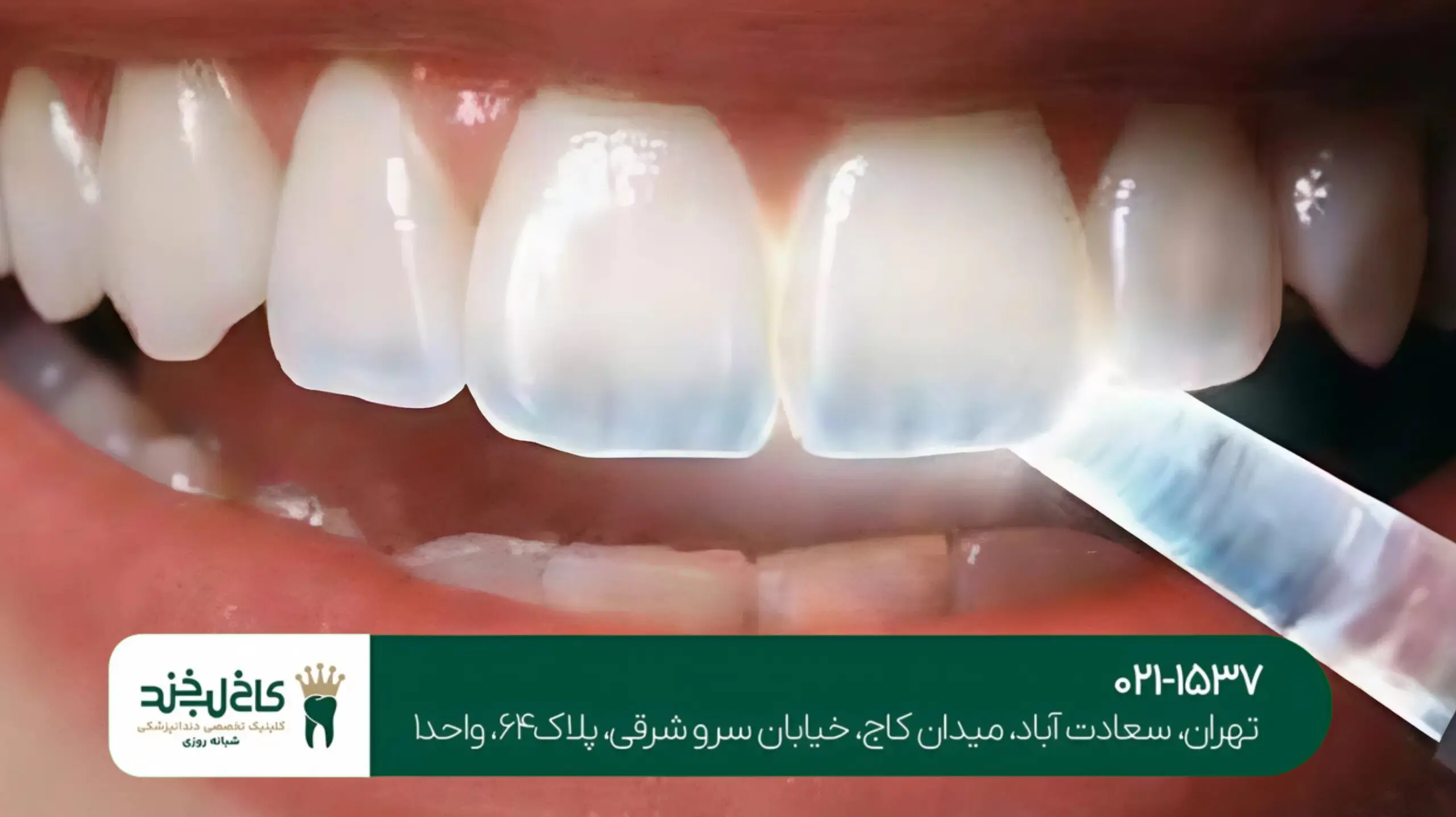 دندانپزشکی اورژانسی