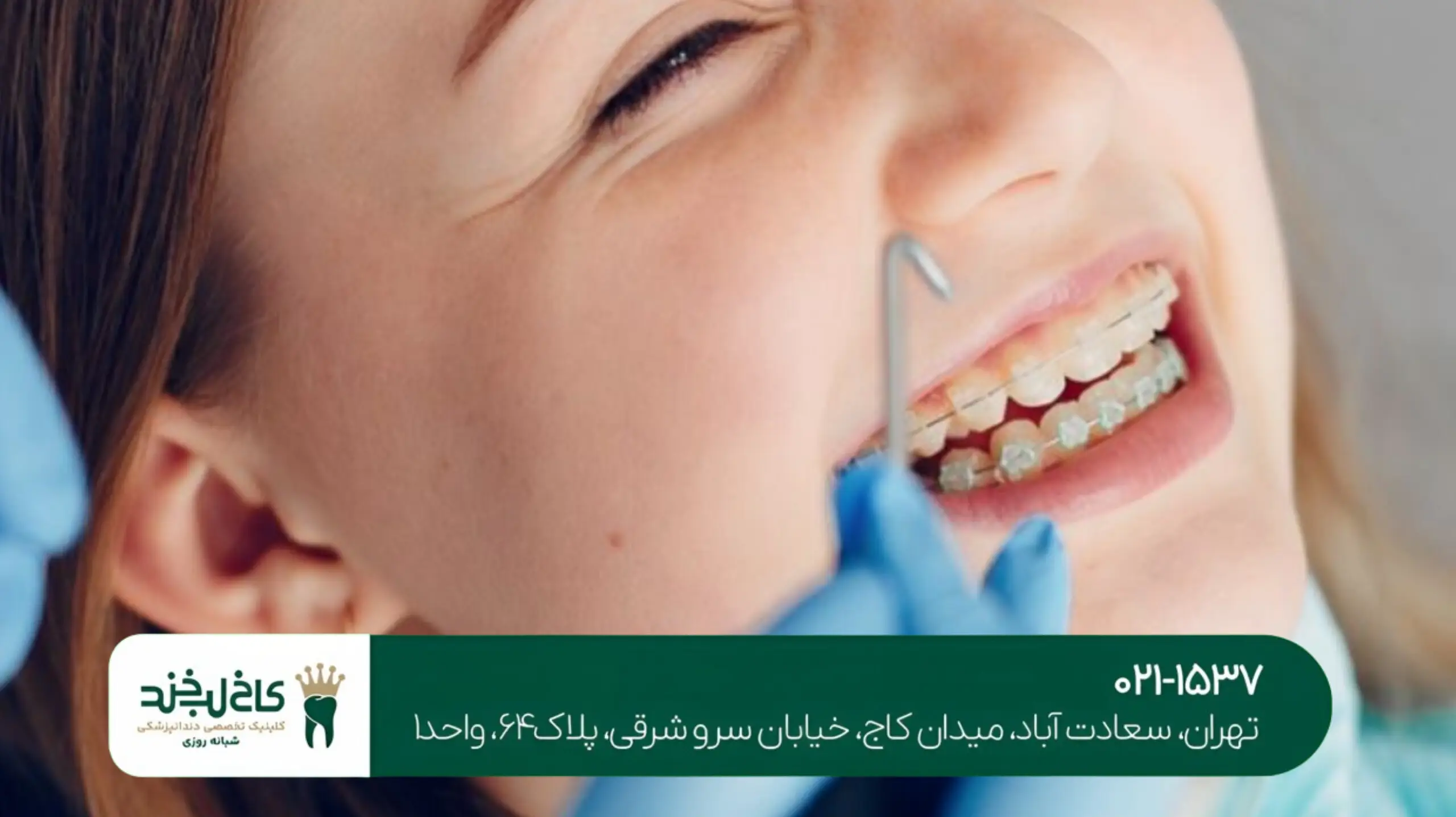 کاشت دندان بدون بخیه