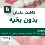 کاشت دندان بدون بخیه