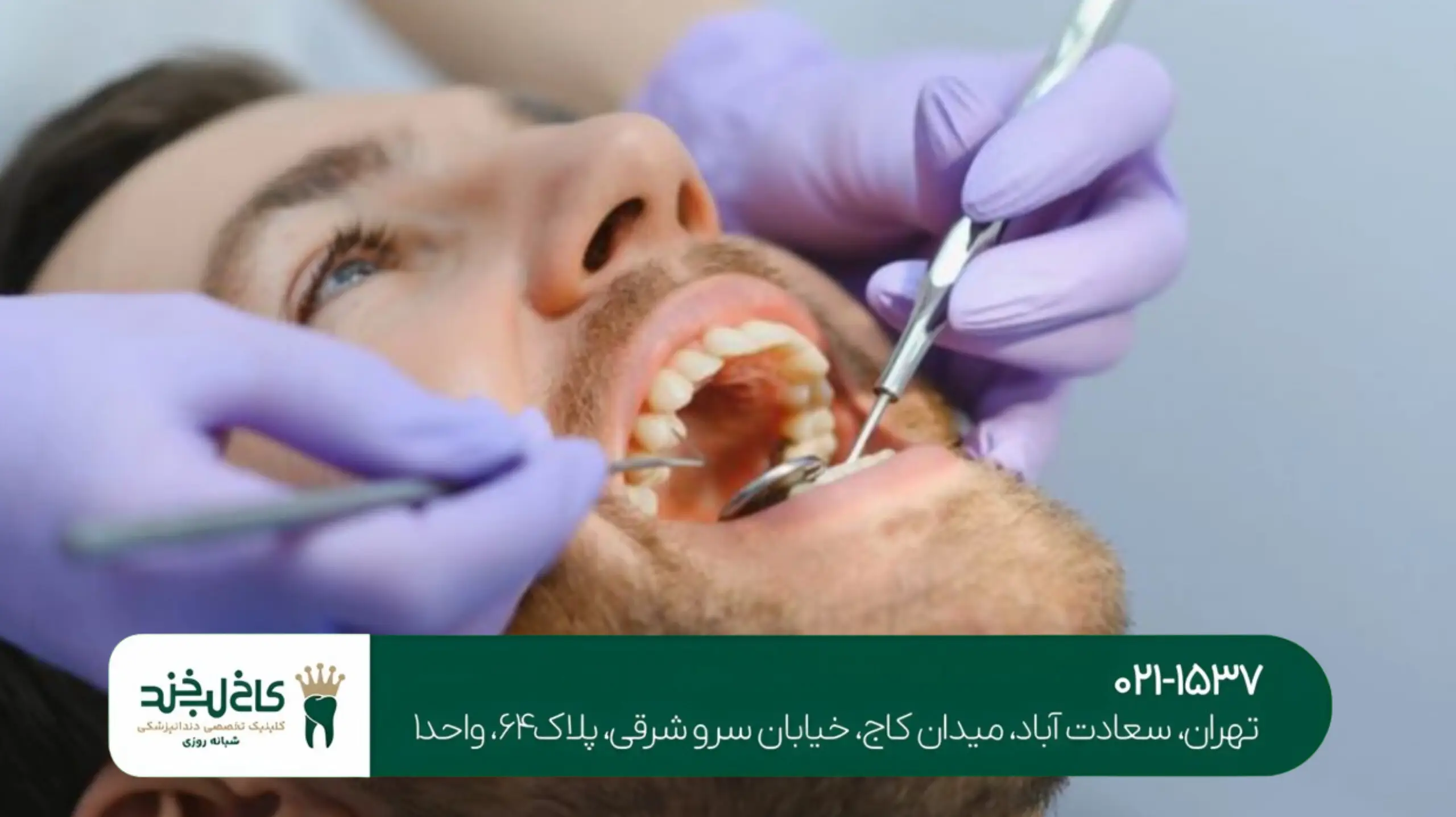 کاشت دندان بدون بخیه