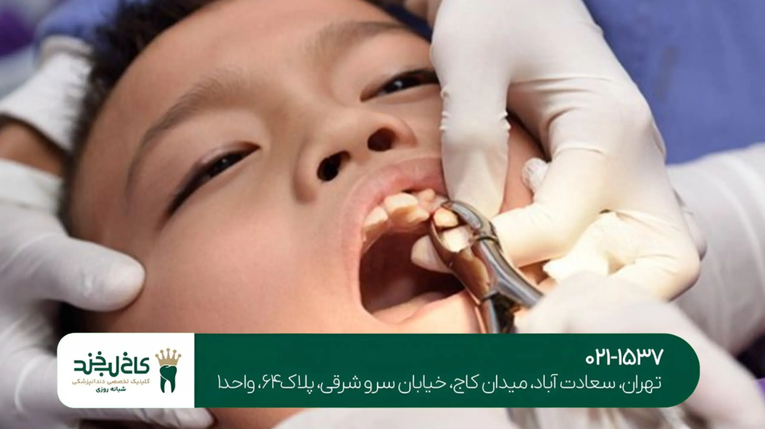 مرکز تخصصی لمینت تهران