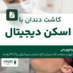 کاشت دندان با اسکن دیجیتال