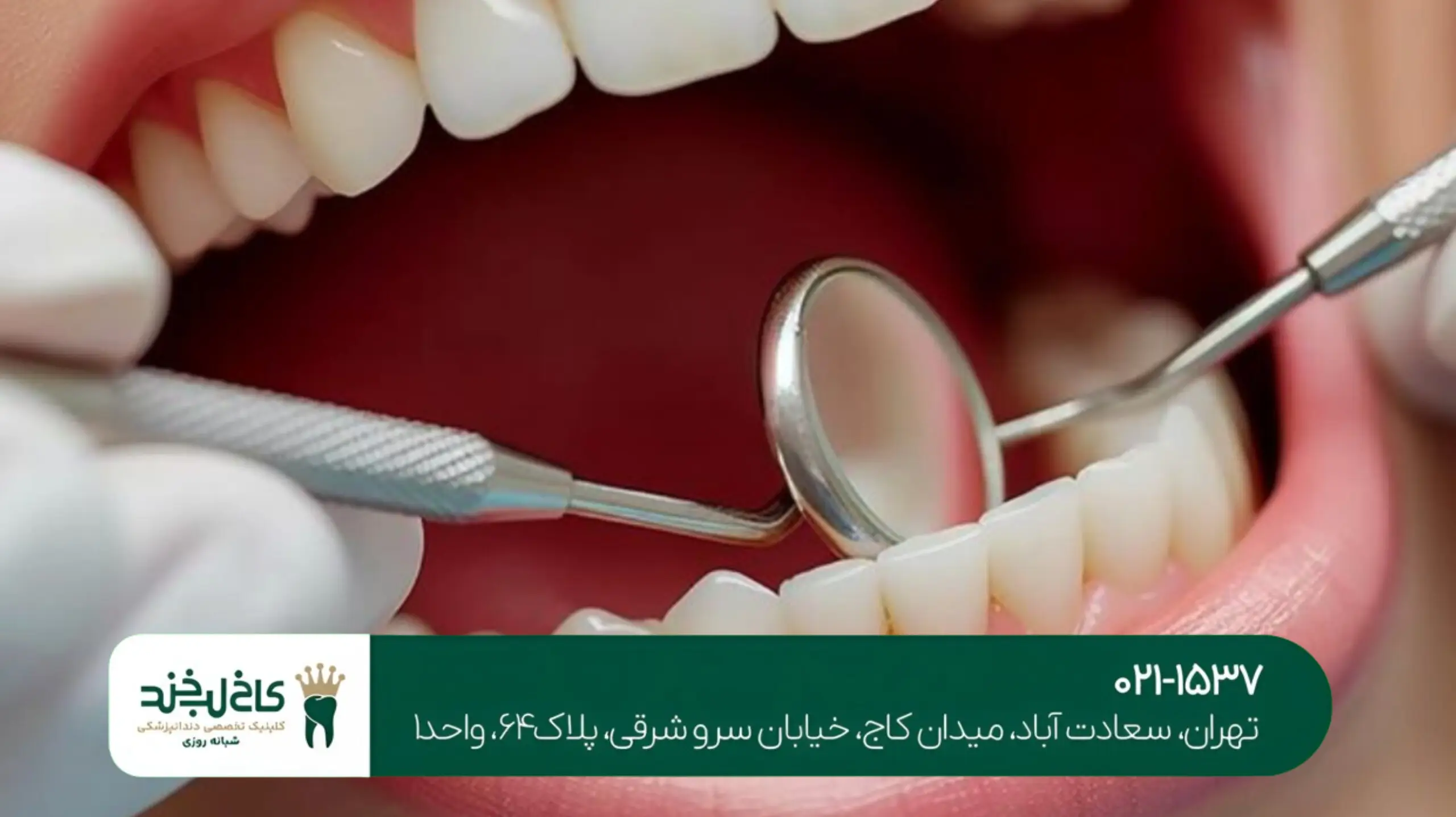 مرکز تخصصی لمینت تهران