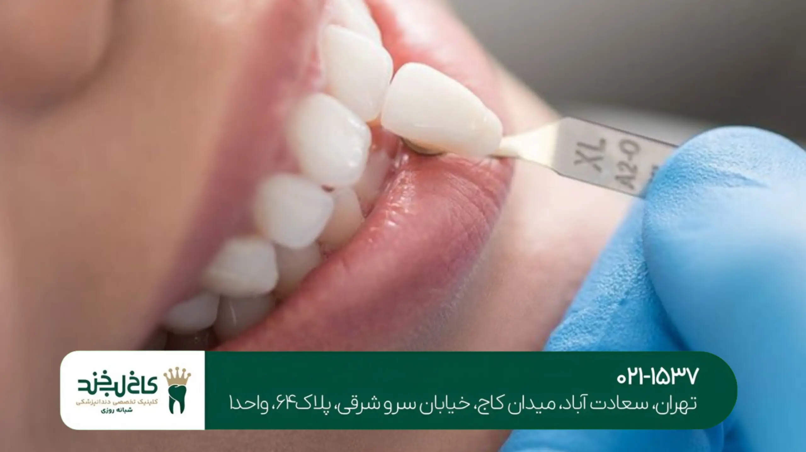 مرکز تخصصی کامپوزیت تهران