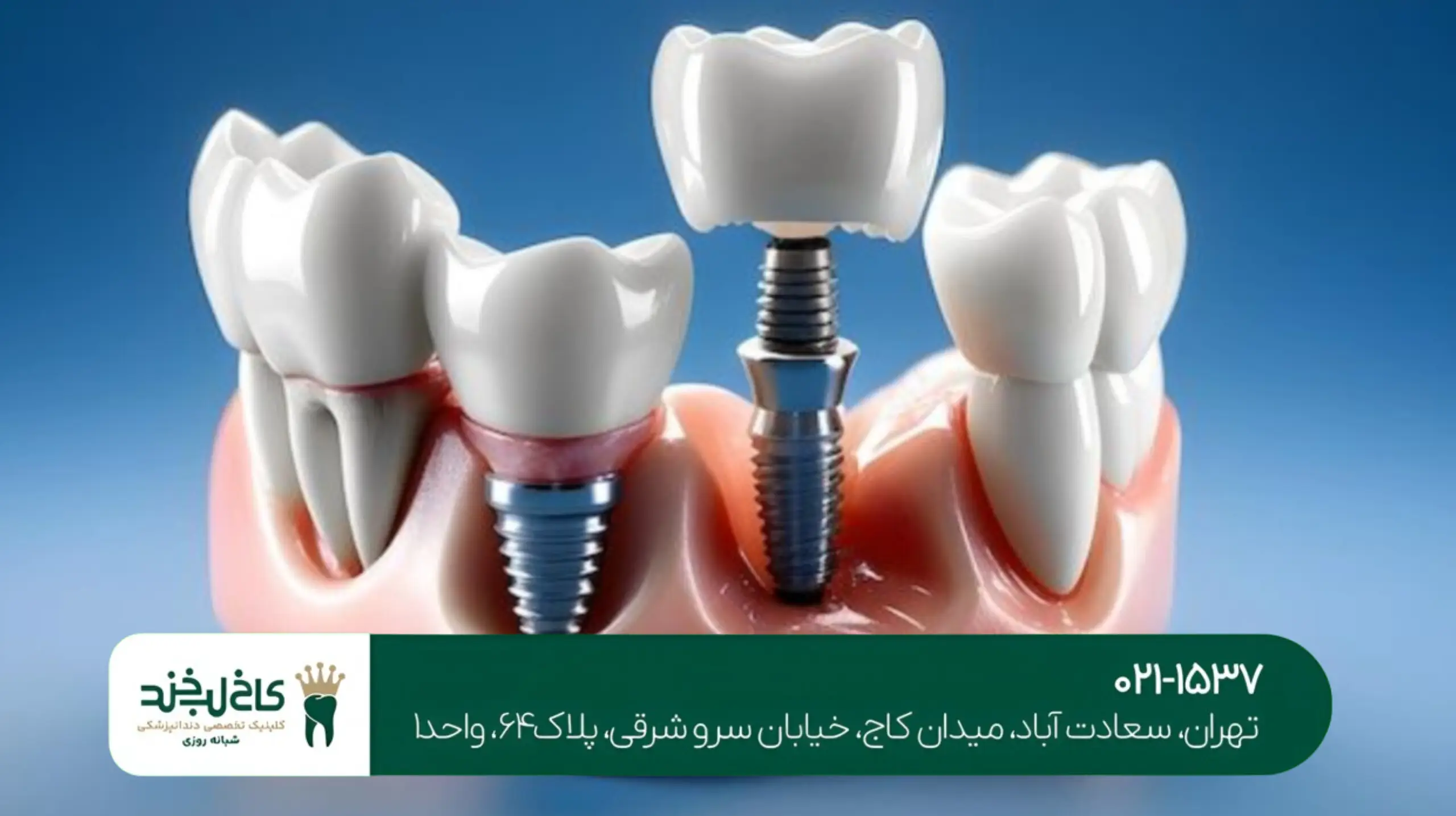مرکز تخصصی لمینت تهران