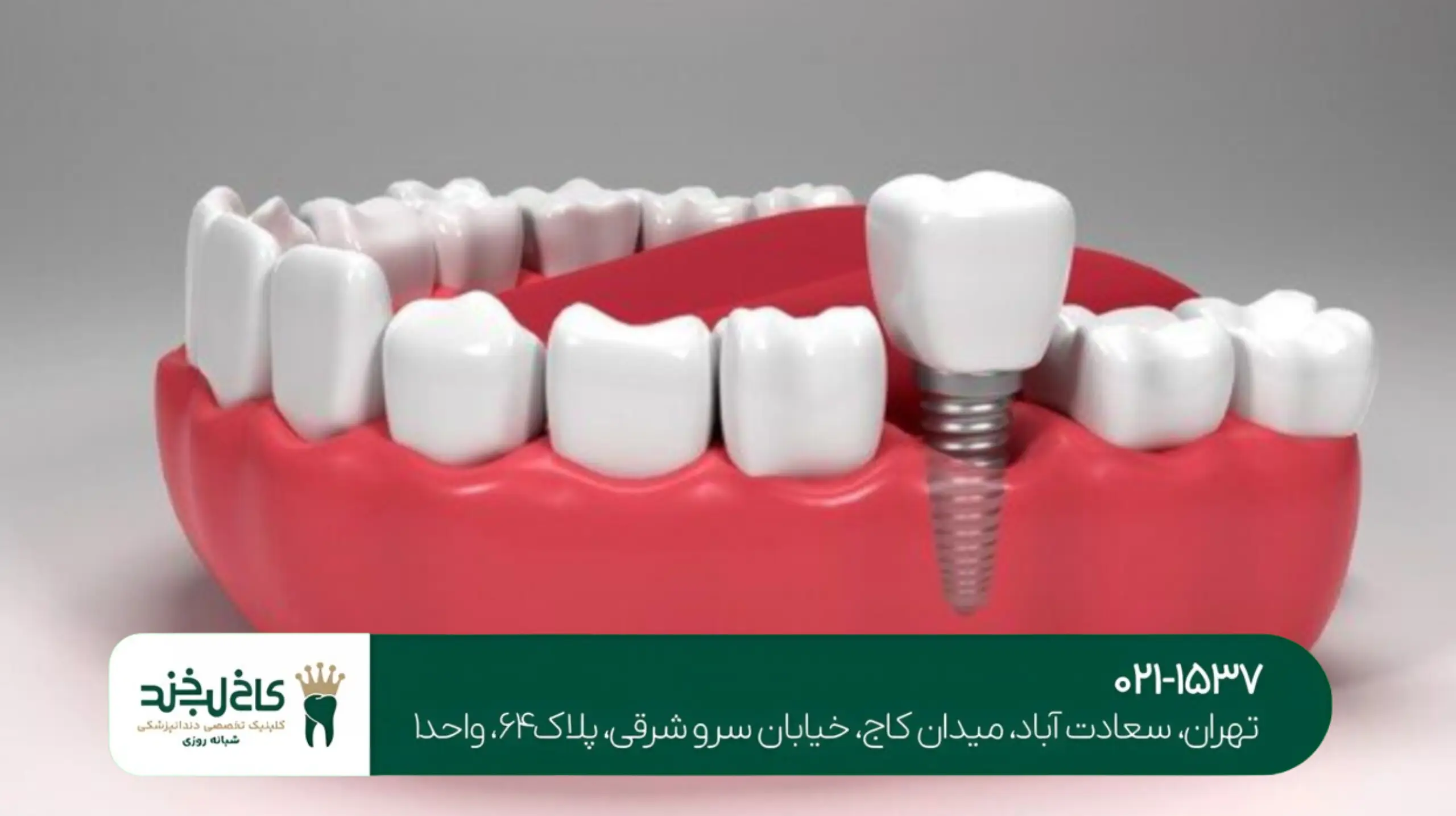 مرکز تخصصی کامپوزیت تهران