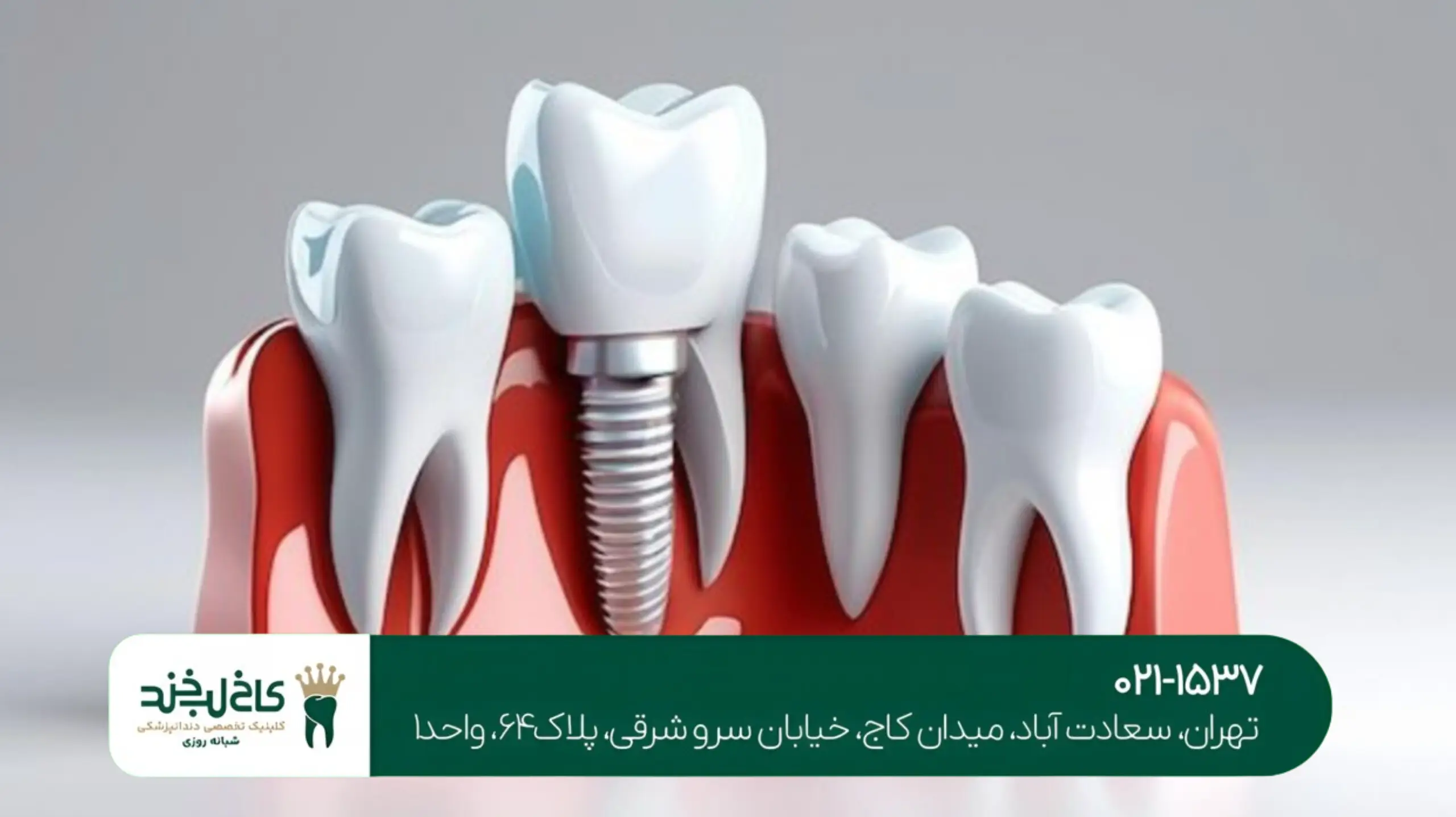 مرکز تخصصی کامپوزیت تهران