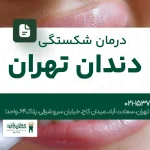 اصلاح ناهماهنگی دندان تهران