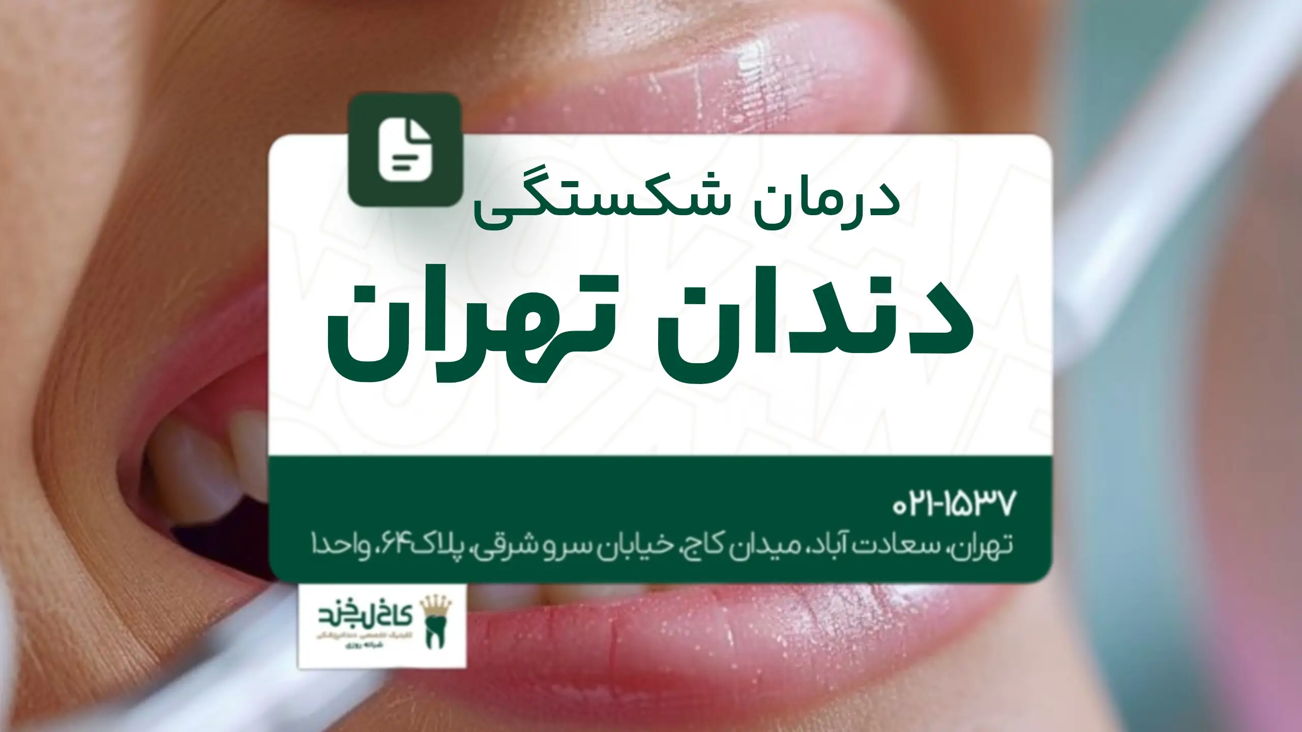 اصلاح ناهماهنگی دندان تهران