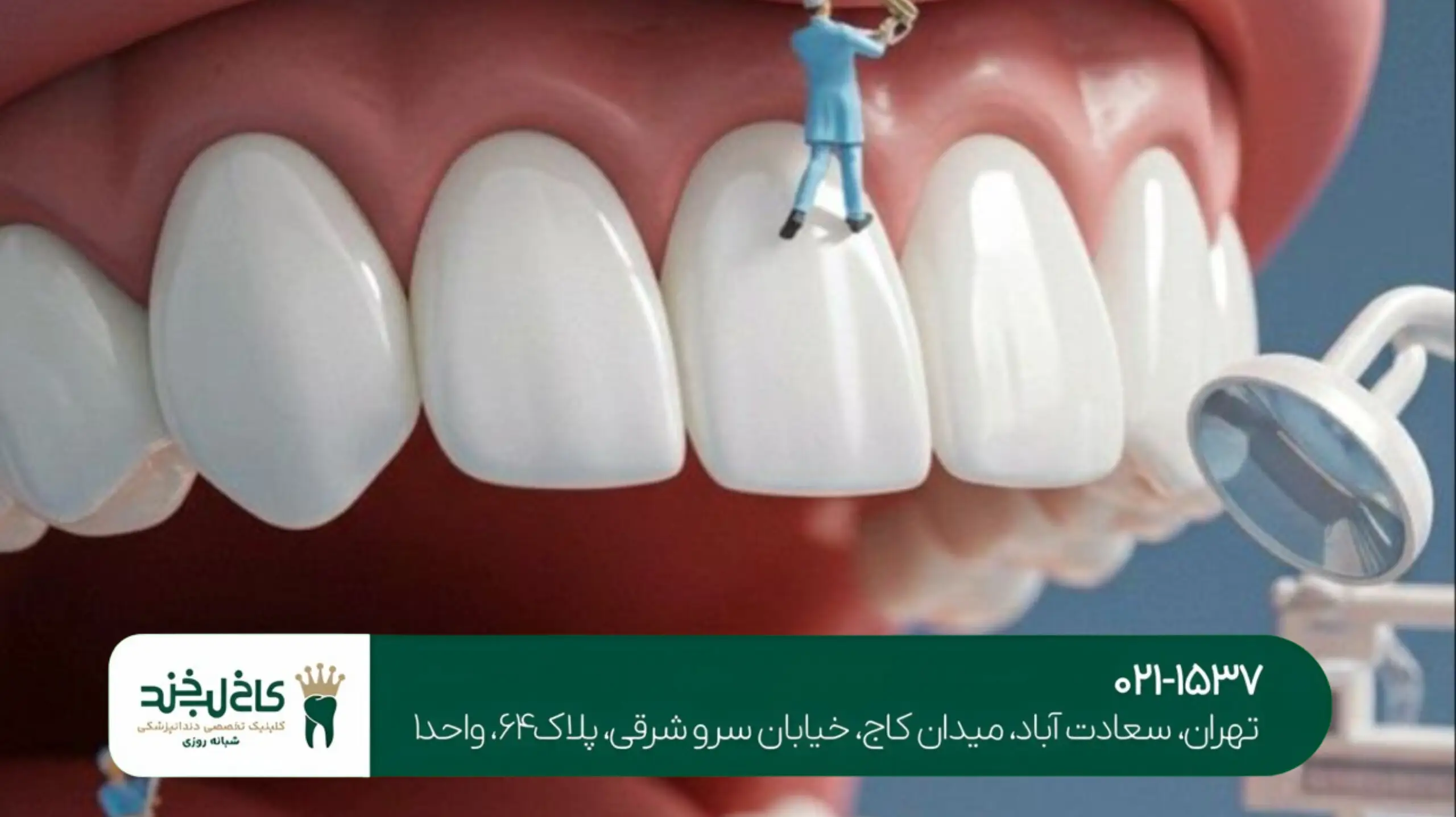 کاشت پایه دندان تهران