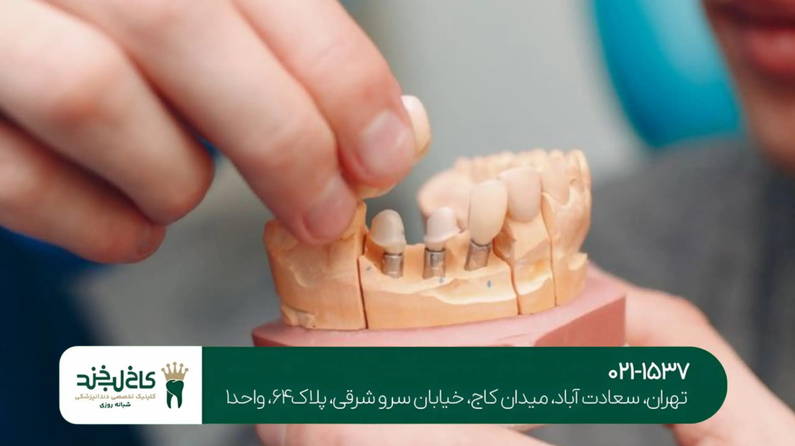 دندانپزشکی تخصصی پروتز تهران