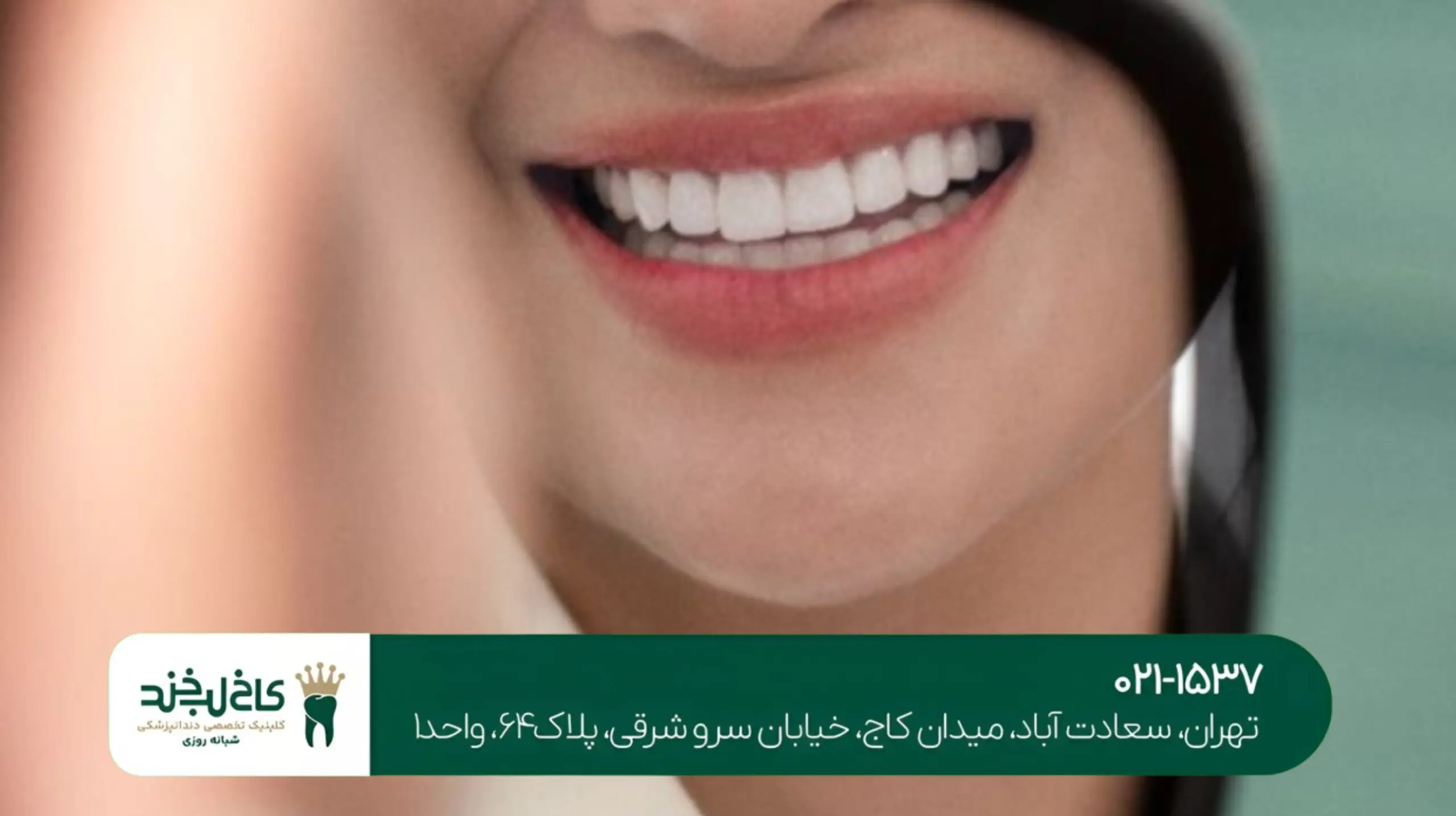 طرح لبخند دیجیتالی تهران