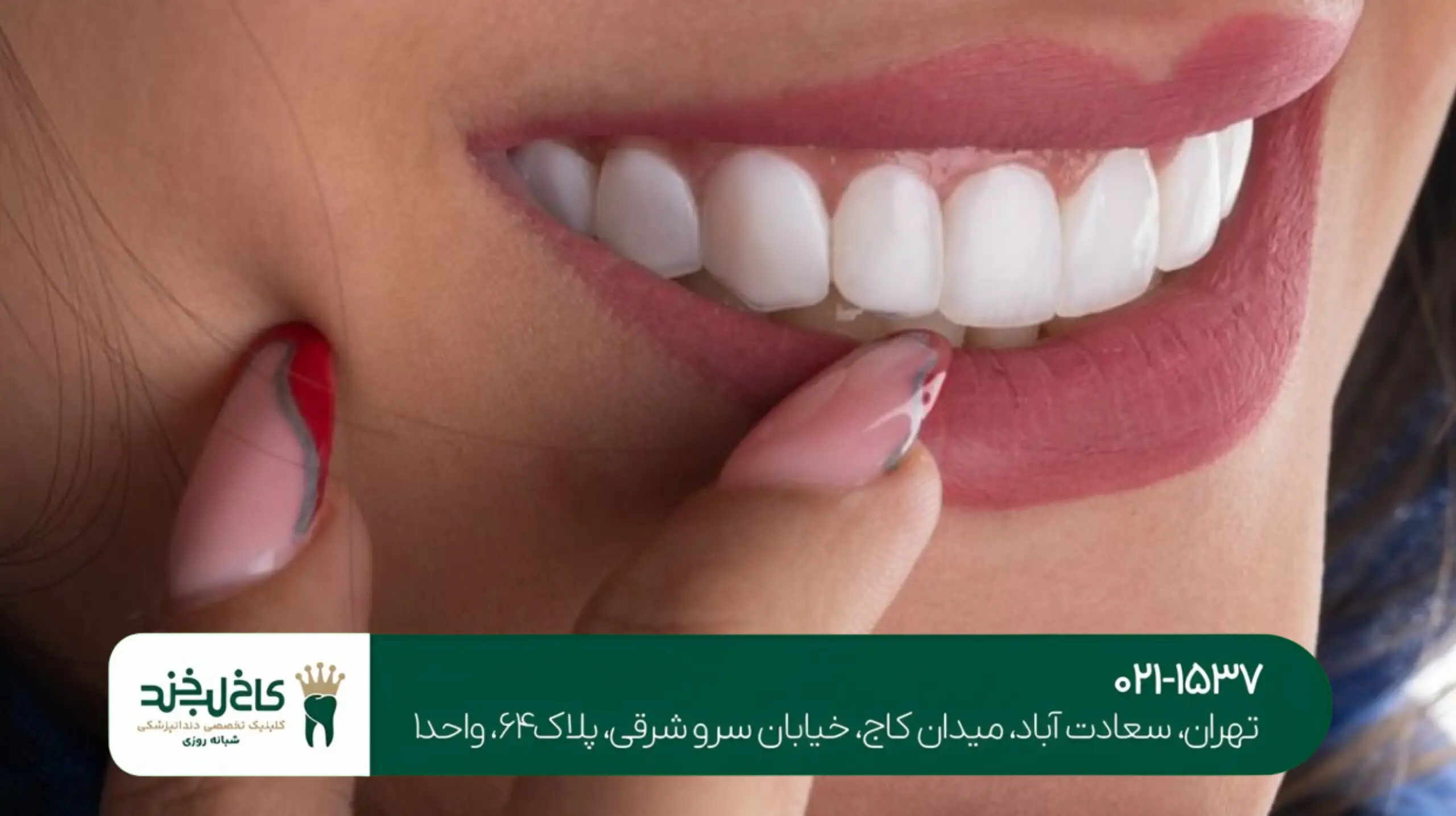 طرح لبخند دیجیتالی تهران