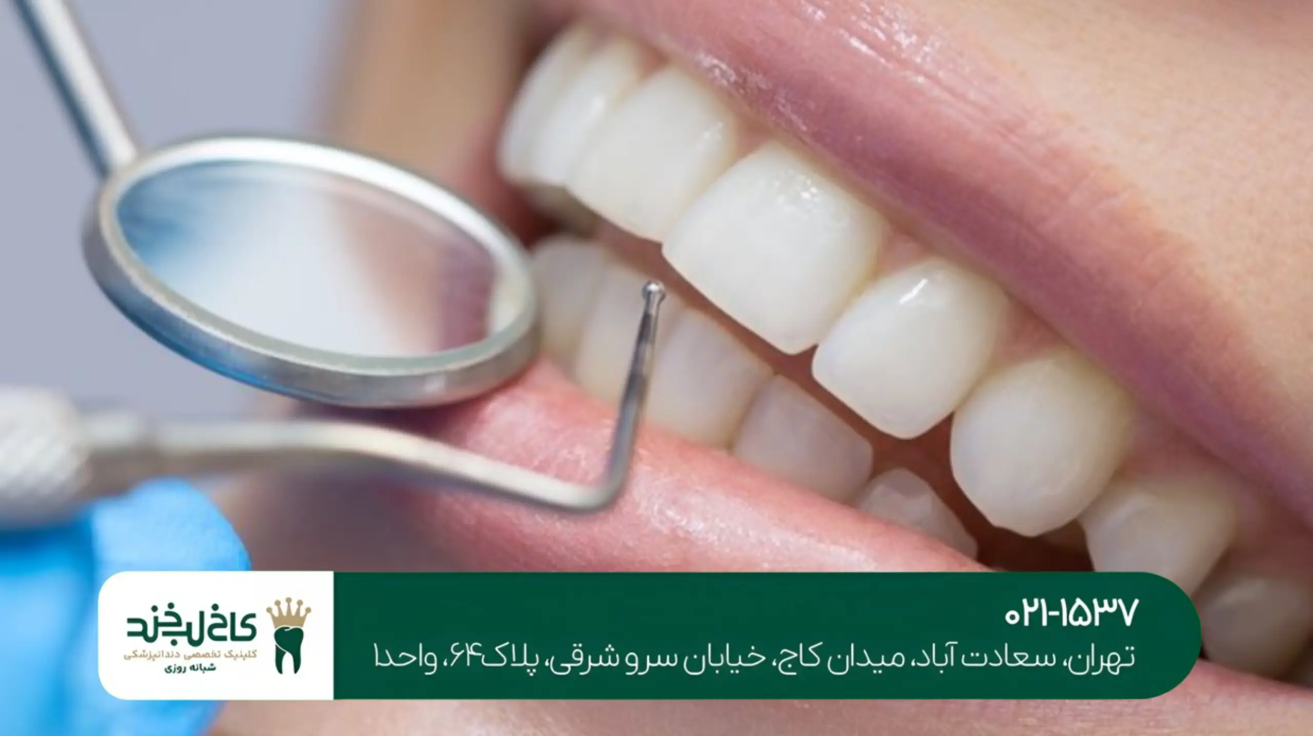 دندانپزشکی تخصصی ریشه تهران