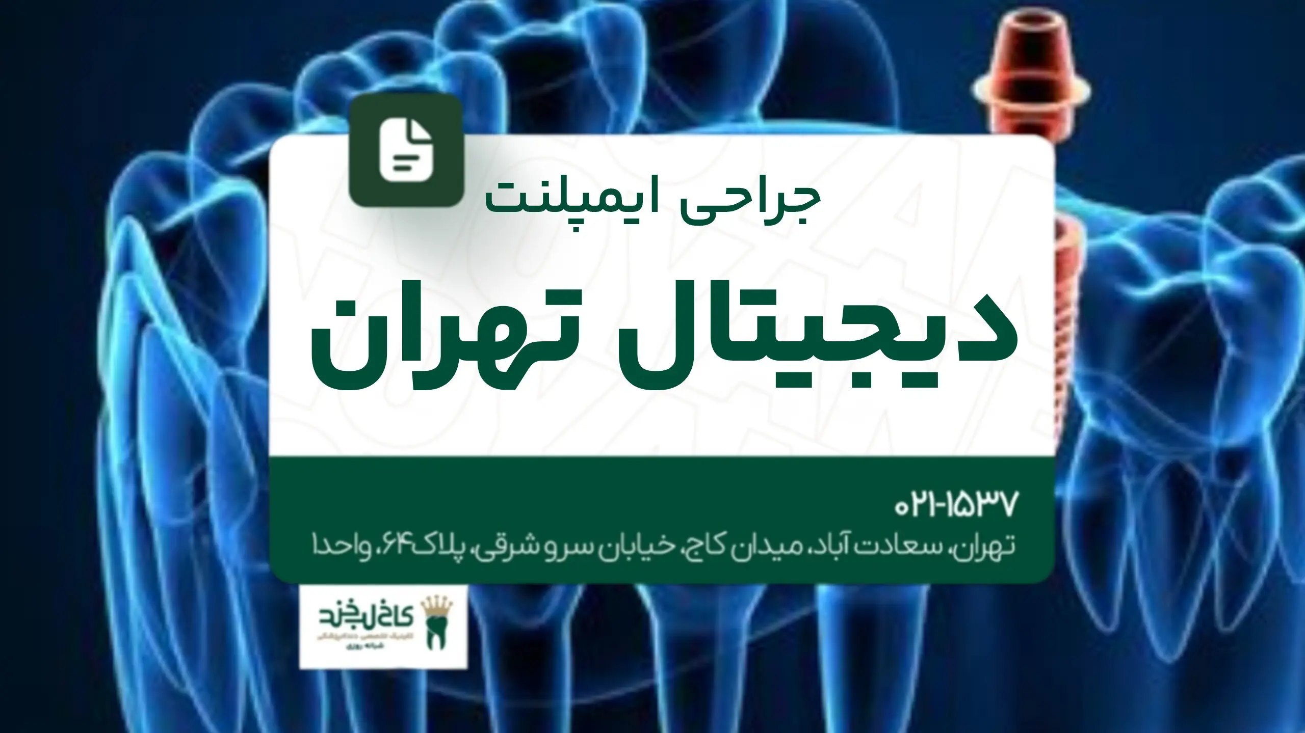جراحی ایمپلنت دیجیتال تهران