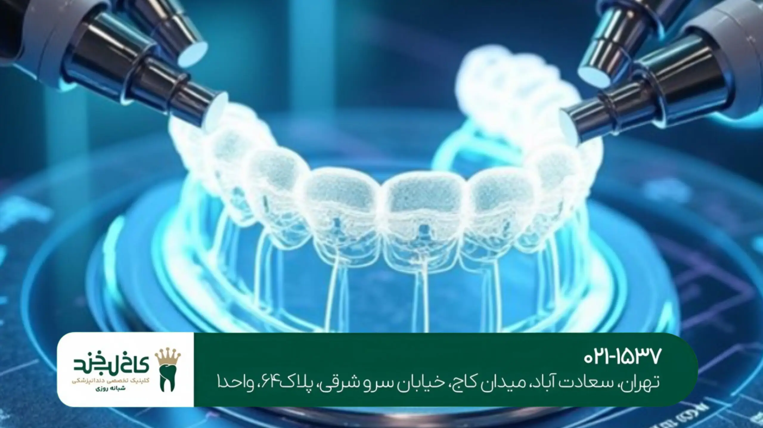 جراحی ایمپلنت دیجیتال تهران